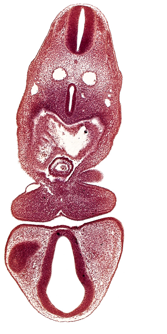 C-1 spinal ganglion primordium, caudal edge of optic vesicle, dermatomyotome 5 (C-1), dorsal aorta, dorsal thalamus (diencephalon), left atrium, mandibular prominence of pharyngeal arch 1, pericardial cavity, primordial maxillary vein, prosencoel (third ventricle), right atrium, tracheo-esophageal tube, truncus arteriosus