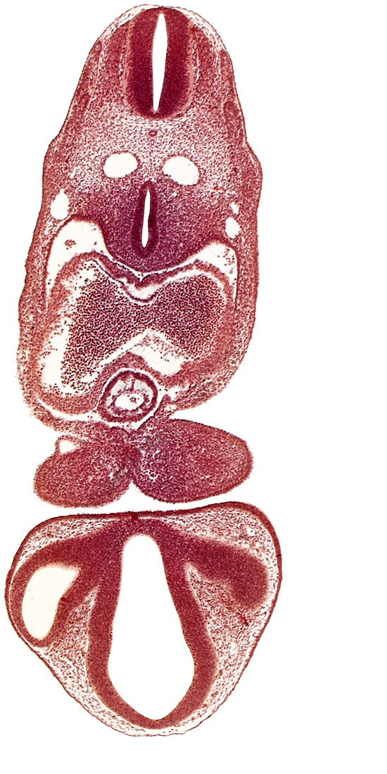 chiasmatic part of diencephalon, dermatomyotome 5 (C-1), dermatomyotome 6 (C-2), dorsal aorta, dorsal thalamus, endocardium, epicardial ridge, epithalamus, left atrium, marginal layer of spinal cord, median mandibular groove, notochord, optic stalk (CN II), pericardial cavity, precardinal vein, prosencoel (third ventricle), right atrium, sclerotome, separation artifact, tracheo-esophageal tube, truncus arteriosus, ventral thalamus