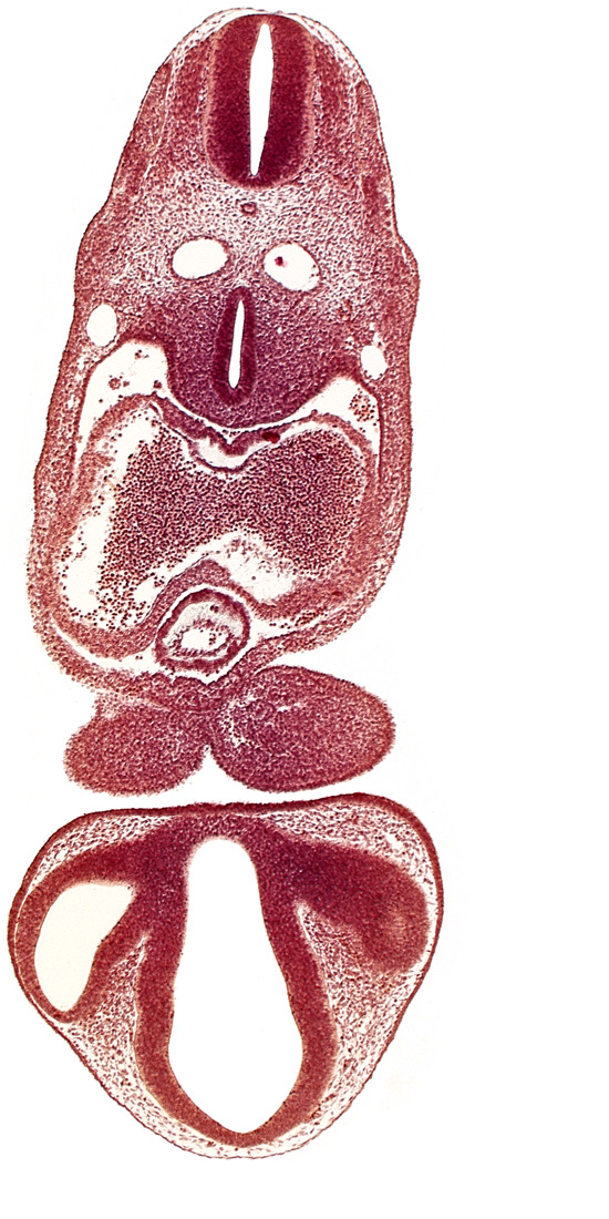 anterior cerebral plexus, chiasmatic part of diencephalon, dermatomyotome 6 (C-2), dorsal aorta, dorsal thalamus, endocardium, epicardial ridge, epithalamus, left atrium, mandibular prominence of pharyngeal arch 1, marginal layer of spinal cord, median mandibular groove, notochord, optic stalk (CN II), pericardial cavity, precardinal vein, prosencoel (third ventricle), right atrium, tracheo-esophageal tube, truncus arteriosus, ventral thalamus