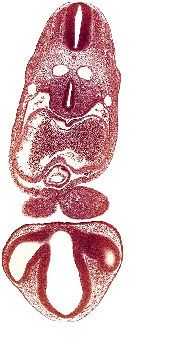 C-2 spinal ganglion primordium, chiasmatic part of diencephalon, dermatomyotome 6 (C-2), dorsal aorta, dorsal thalamus, endocardium, epicardial ridge, epithalamus, gelatinous reticulum, interatrial foramen (primum), intraretinal space (optic vesicle cavity), left atrium, mandibular prominence of pharyngeal arch 1, marginal layer of spinal cord, median mandibular groove, notochord, optic stalk (CN II), optic vesicle, pericardial cavity, precardinal vein, prosencoel (third ventricle), right atrium, sclerotome, stomodeum, tracheo-esophageal tube, truncus arteriosus, ventral thalamus