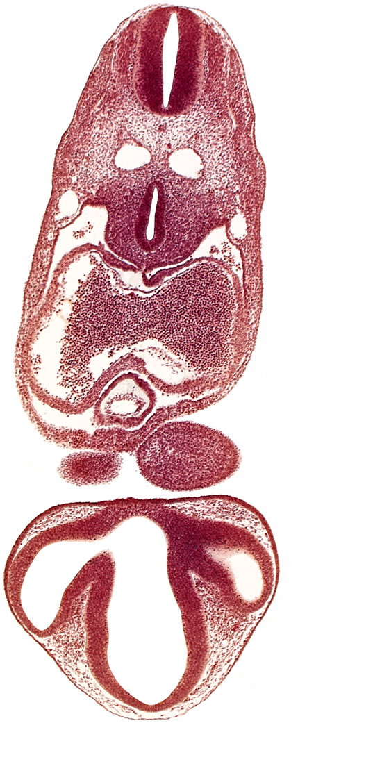 C-2 spinal ganglion primordium, caudal edge of pharyngeal arch 1, dermatomyotome 6 (C-2), dorsal aorta, dorsal thalamus, epithalamus, interatrial foramen (primum), intraretinal space (optic vesicle cavity), junction of conus cordis and truncus arteriosus, left atrium, mesocardium, notochord, optic vesicle, pericardial cavity, precardinal vein, prosencoel (third ventricle), right atrium, stomodeum, tracheo-esophageal tube, ventral thalamus