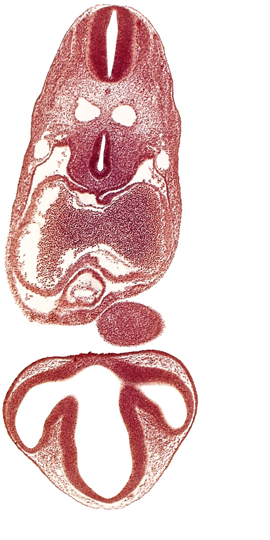 C-2 spinal ganglion primordium, dermatomyotome 6 (C-2), dorsal thalamus, epithalamus, junction of dorsal aorta and intersegmental artery, left atrium, mandibular prominence of pharyngeal arch 1, mesocardium, notochord, optic vesicle, pericardial cavity, precardinal vein, primary interatrial septum (septum primum), prosencoel (third ventricle), right atrium, tracheo-esophageal tube, ventral thalamus