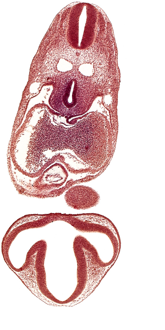 C-2 spinal ganglion primordium, dermatomyotome 6 (C-2), dorsal thalamus, epithalamus, left atrium, mandibular prominence of pharyngeal arch 1, mesocardium, notochord, optic vesicle, pericardial cavity, precardinal vein, prosencoel (third ventricle), right atrium, tracheo-esophageal tube, ventral thalamus