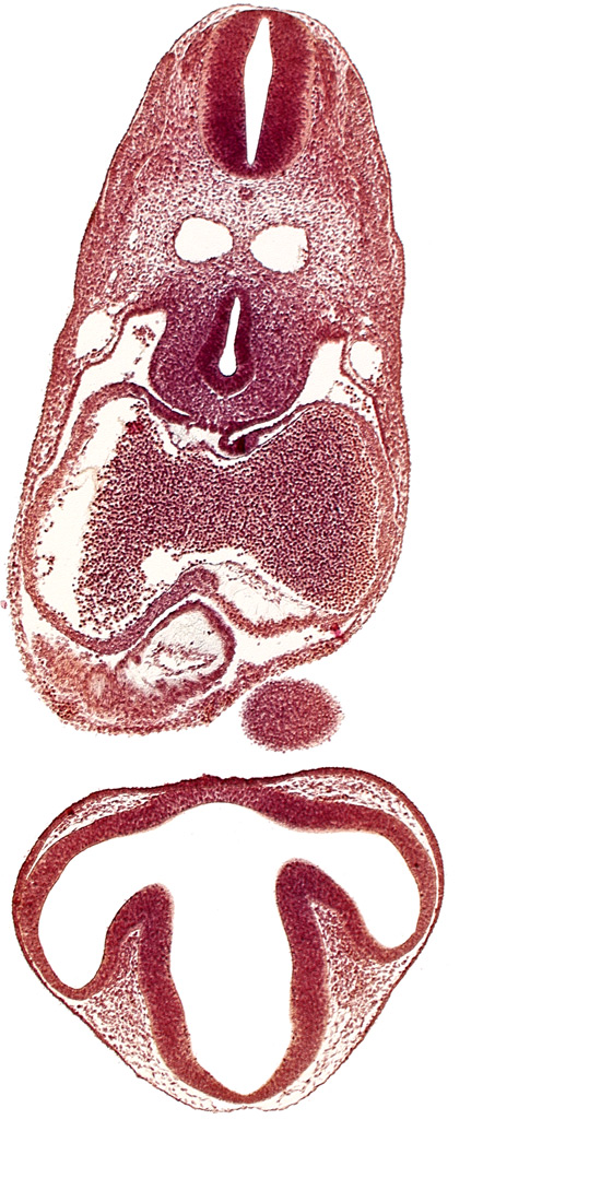C-2 spinal ganglion primordium, cephalic edge of right ventricle, conus cordis, dermatomyotome 6 (C-2), dorsal aorta, dorsal thalamus, epithalamus, left atrium, mandibular prominence of pharyngeal arch 1, mesocardium, notochord, optic vesicle, pericardial cavity, precardinal vein, primary interatrial septum (septum primum), prosencoel (third ventricle), right atrial wall, tracheo-esophageal tube, ventral thalamus