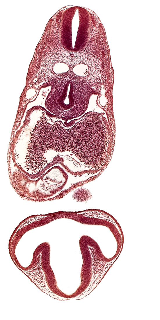 C-2 spinal ganglion primordium, caudal edge of mandibular prominence of pharyngeal arch 1, communication of prosencoel (third ventricle) with optic vesicle, dermatomyotome 6 (C-2), dorsal aorta, dorsal thalamus, epithalamus, left atrium, mesocardium, notochord, optic vesicle, pericardial cavity, precardinal vein, prosencoel (third ventricle), right atrial wall, right ventricle, tracheo-esophageal tube, ventral thalamus