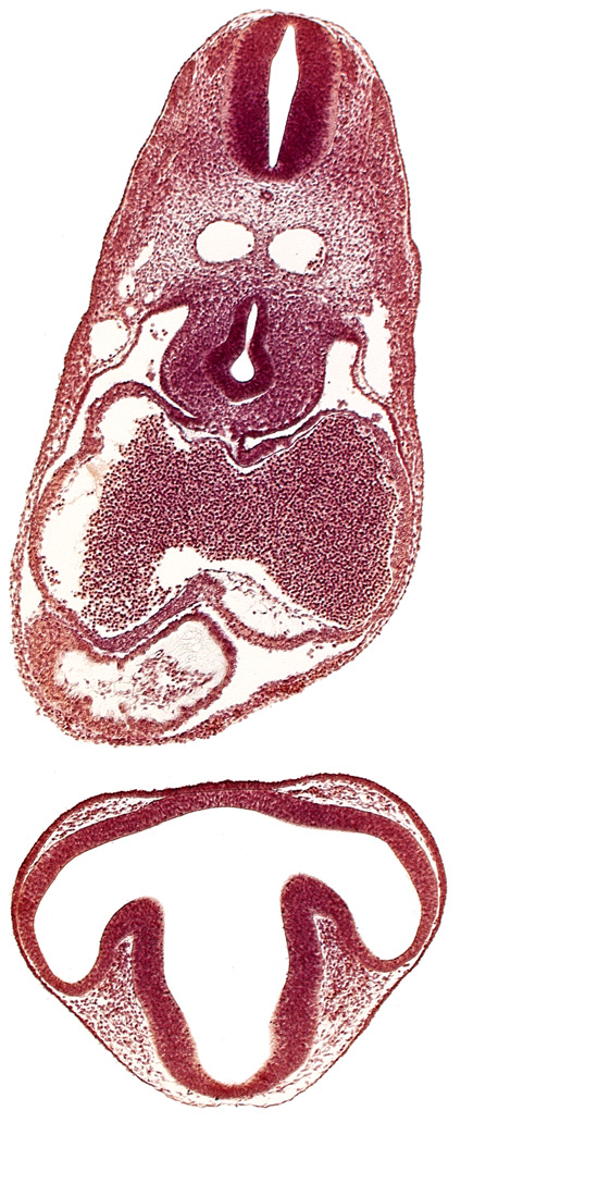 bulbis cordis, dermatomyotome 6 (C-2), diencephalon, dorsal aorta, esophagus primordium, intraretinal space (optic vesicle cavity), junction of postcardinal and precardinal veins, lens disc, mesocardium, nucleated red blood cells in left atrium, ostium primum, pericardial cavity, precardinal vein, primary interatrial septum (septum primum), right atrium, trachea primordium