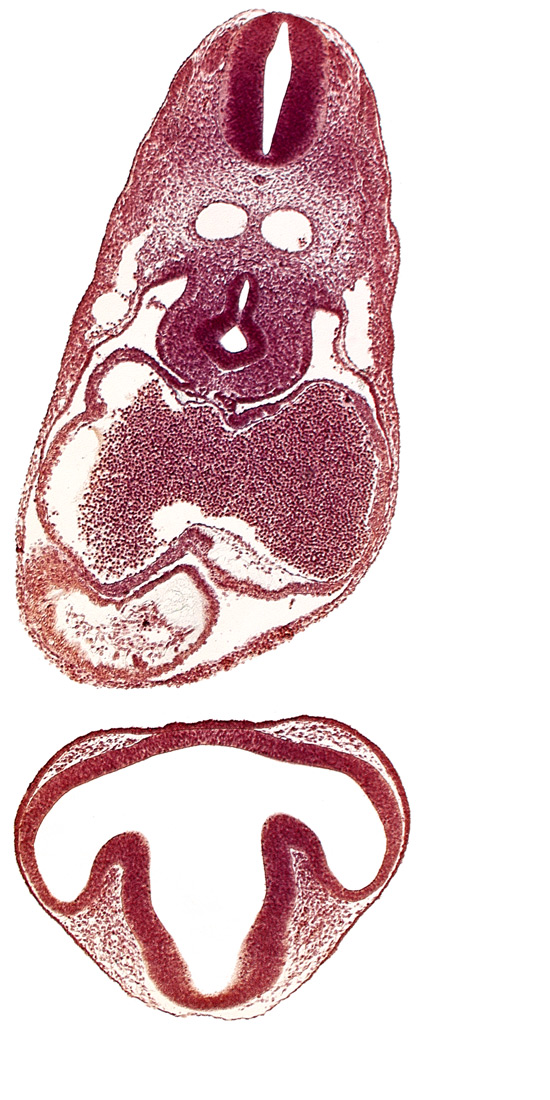 bulbis cordis, dermatomyotome 6 (C-2), diencephalon, dorsal aorta, esophagus primordium, intraretinal space (optic vesicle cavity), junction of postcardinal and precardinal veins, lens disc, mesocardium, nucleated red blood cells in left atrium, ostium primum, pericardial cavity, precardinal vein, primary interatrial septum (septum primum), right atrium, trachea primordium