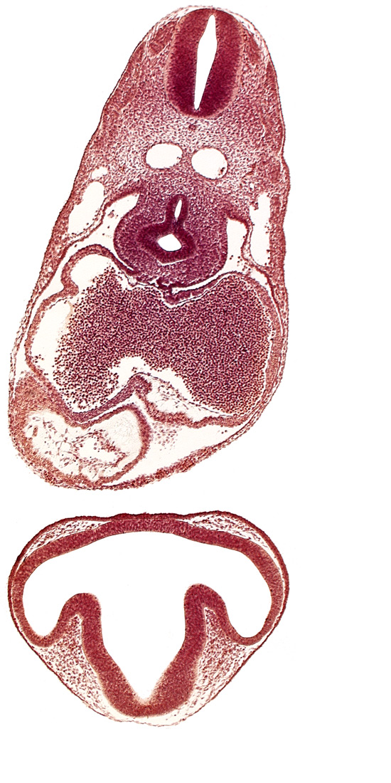 dermatomyotome 6 (C-2), diencephalon, dorsal aorta, esophagus primordium, intraretinal space (optic vesicle cavity), junction of postcardinal and precardinal veins, lens disc, nucleated red blood cells in left atrium, pericardial cavity, primary interatrial septum (septum primum), right atrium, sinus venosus, trachea primordium