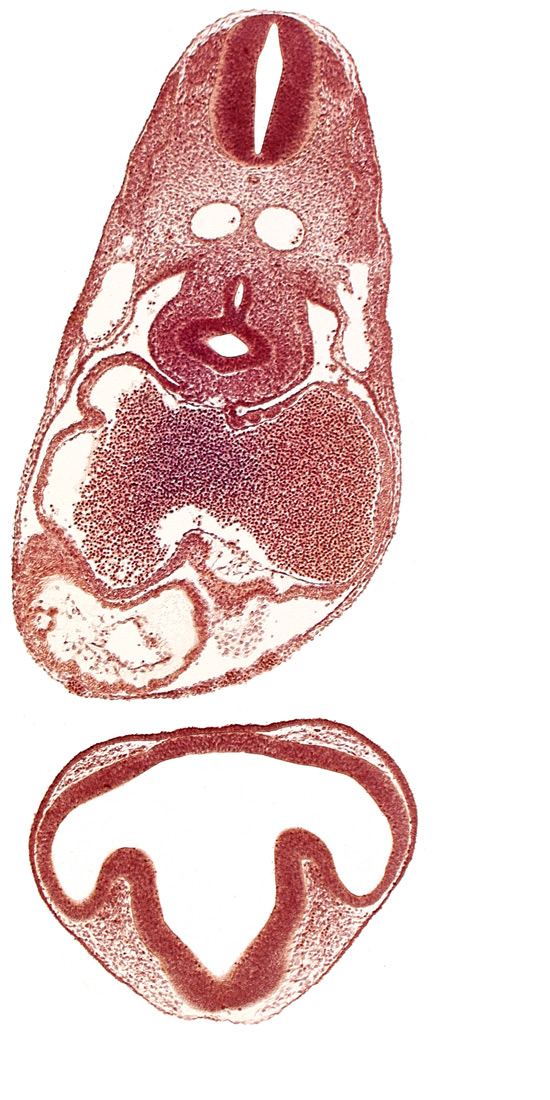 C-2 spinal ganglion primordium, blood cells in left atrium, conus cordis, dermatomyotome 6 (C-2), diencephalon, endocardium, epimyocardium, esophagus primordium, intraretinal space (optic vesicle cavity), mesocardium, notochord, optic part of retina, optic stalk (CN II), ostium primum, pericardial cavity, pericardial sac, pericardioperitoneal canal (pleural cavity), precardinal vein, prosencoel (third ventricle), right aorta, right atrium, right lung bud, sinus venosus