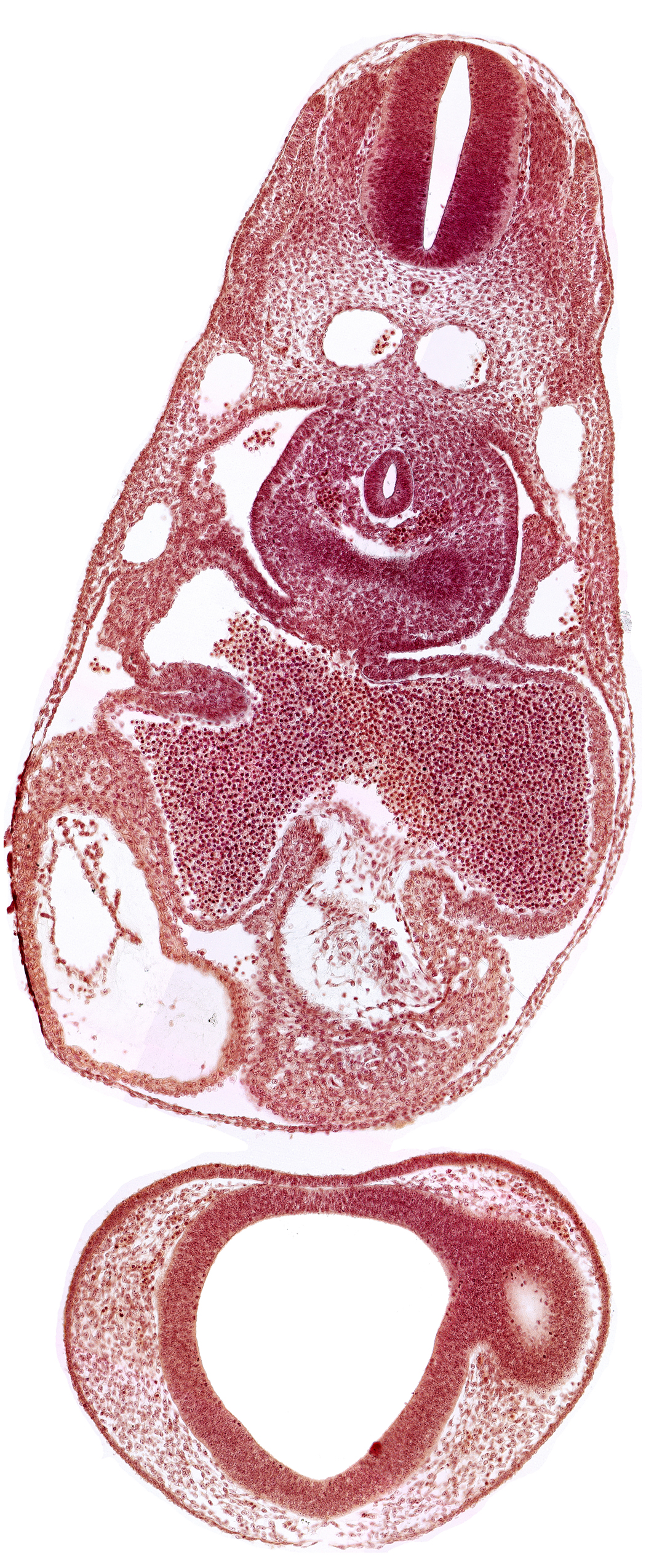 common atrioventricular canal, common cardinal vein, dermatomyotome 7 (C-3), endocardium, epimyocardium, esophagus primordium, intraretinal space (optic vesicle cavity), left atrium, left lung bud, notochord, postcardinal vein, prosencoel (third ventricle), right atrium, sinu-atrial foramen, sinus venosus