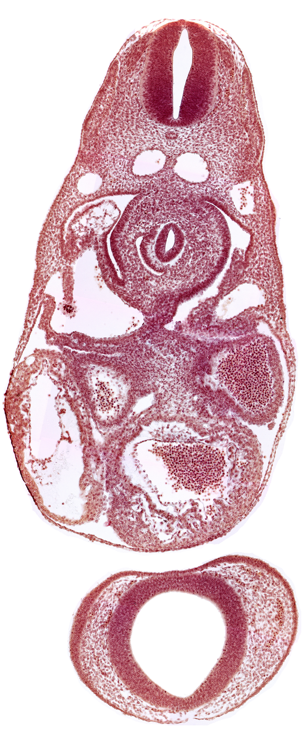 C-3 spinal ganglion primordium, dermatomyotome 7 (C-3), dorsal aorta, endocardium, left atrium, left common cardinal vein, notochord, postcardinal vein, prosencephalon (telencephalic part), prosencoel (third ventricle), right atrium, sinus venosus, trabecular part of left ventricle