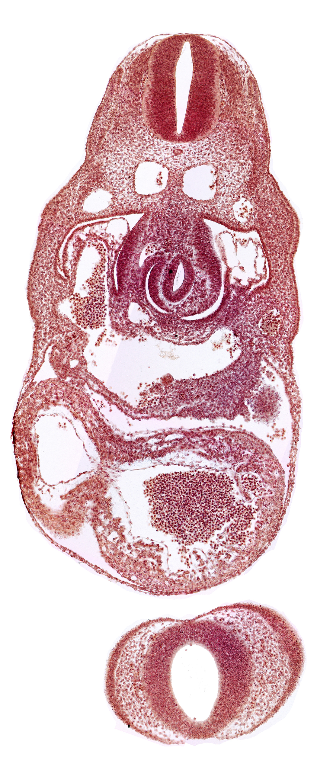 C-3 spinal ganglion primordium, caudal edge of left atrium, dermatomyotome 8 (C-4), dorsal aorta, left ventricle, nasal disc (olfactory placode), notochord, pericardial cavity, postcardinal vein, prosencephalon (telencephalic part), prosencoel (third ventricle), sinus venosus, stomach primordium