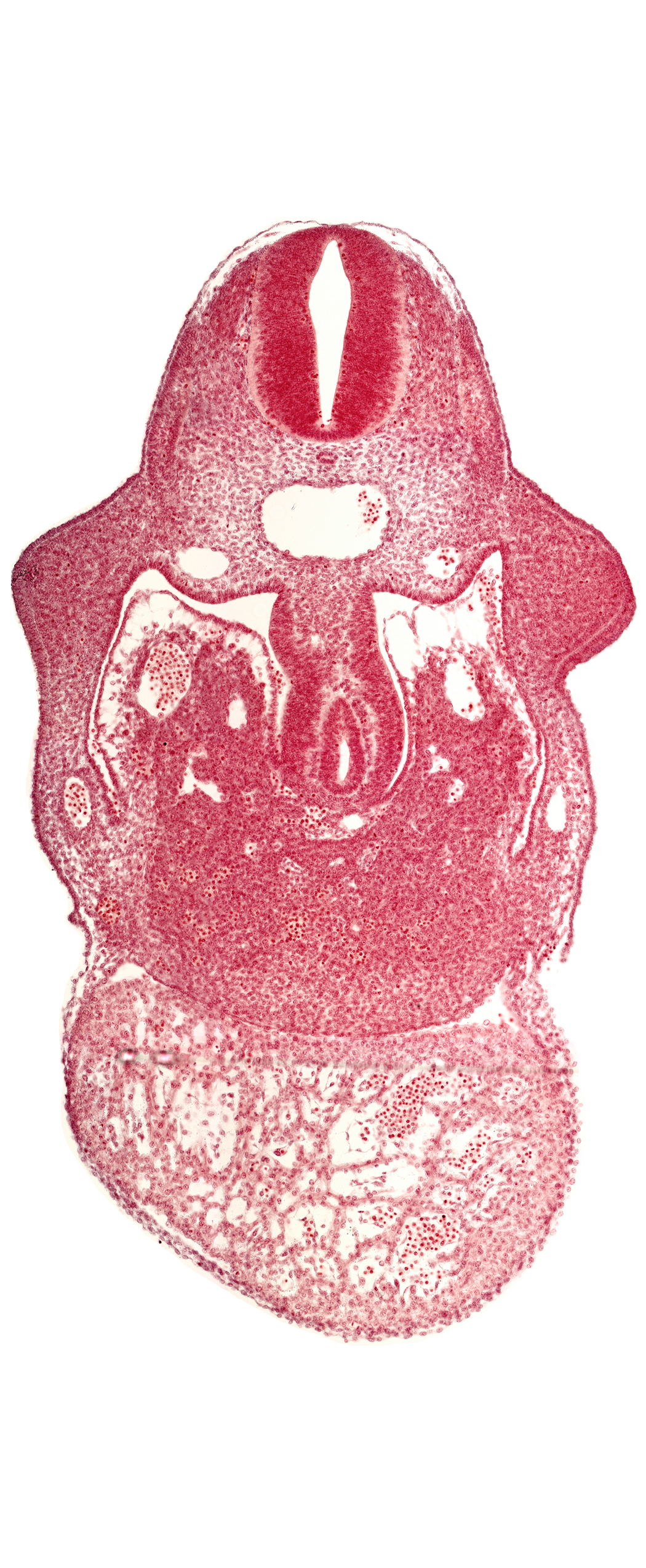 alar plate(s), basal plate, coelomic cavity, common aorta, duodenum primordium, hepatic lamina(e), hepatic sinusoid, notochord, postcardinal vein, septum transversum, specialized coelomic wall, upper limb bud