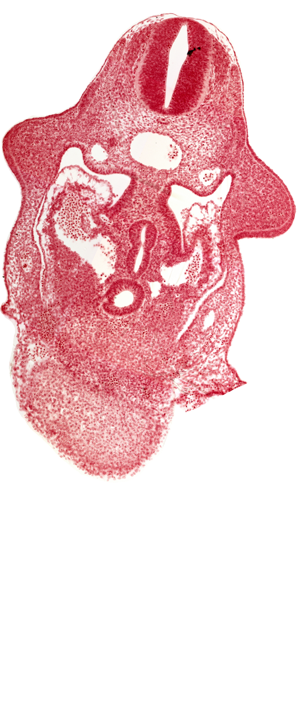 C-5 spinal ganglion primordium, amnion attachment, aorta, caudal edge of common ventricle, dermatomyotome 9 (C-5), dorsal pancreatic bud, hepatic antrum, left hepatocardiac vein, notochord, postcardinal vein, right hepatocardiac vein, septum transversum, specialized coelomic wall, upper limb bud