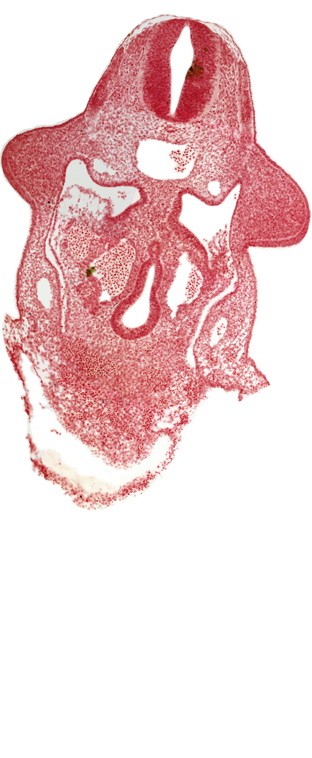 amnion attachment, aorta, apical ectodermal ridge, dermatomyotome 9 (C-5), dorsal pancreatic bud, duodenum primordium, hepatic antrum, marginal layer, neural tube, notochord, postcardinal vein, sulcus limitans, upper limb bud