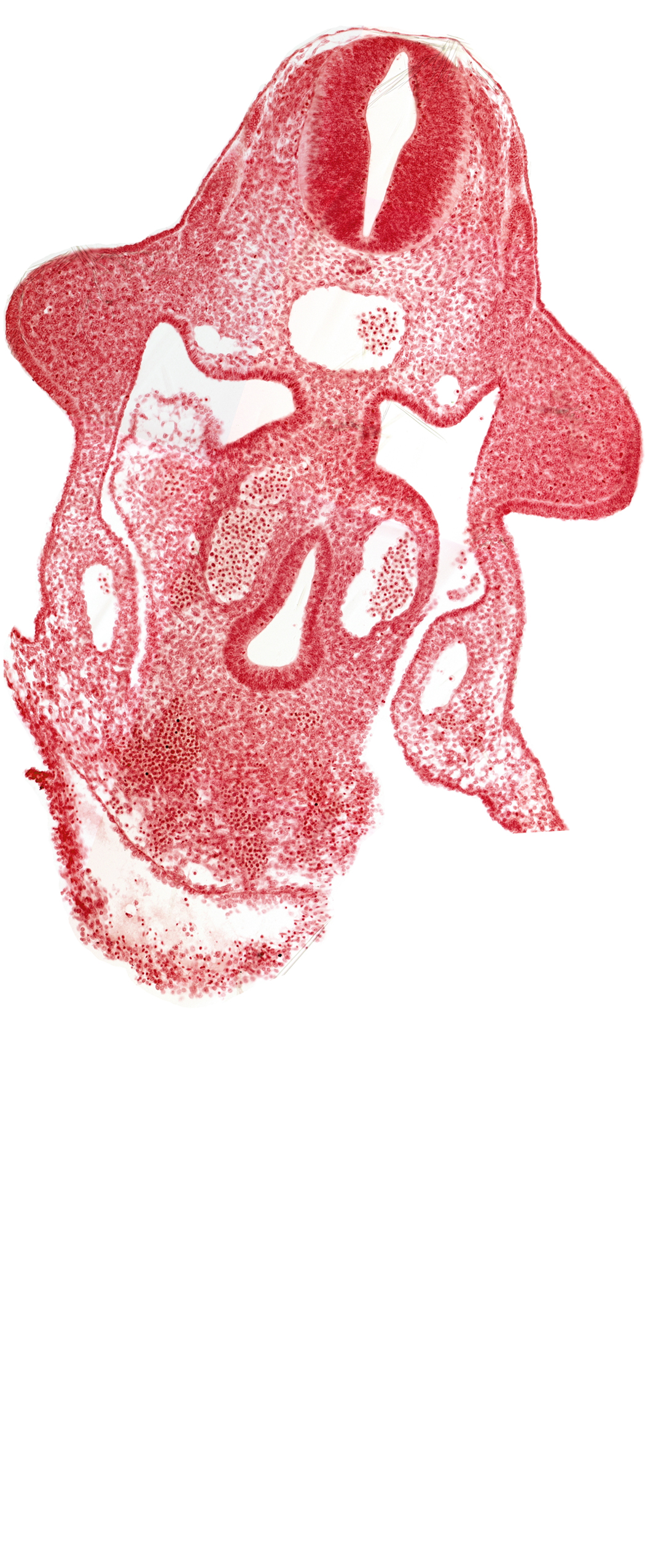 amnion attachment, aorta, apical ectodermal ridge, dermatomyotome 9 (C-5), duodenum primordium, hepatic antrum, marginal layer, neural tube, notochord, postcardinal vein, sulcus limitans, upper limb bud