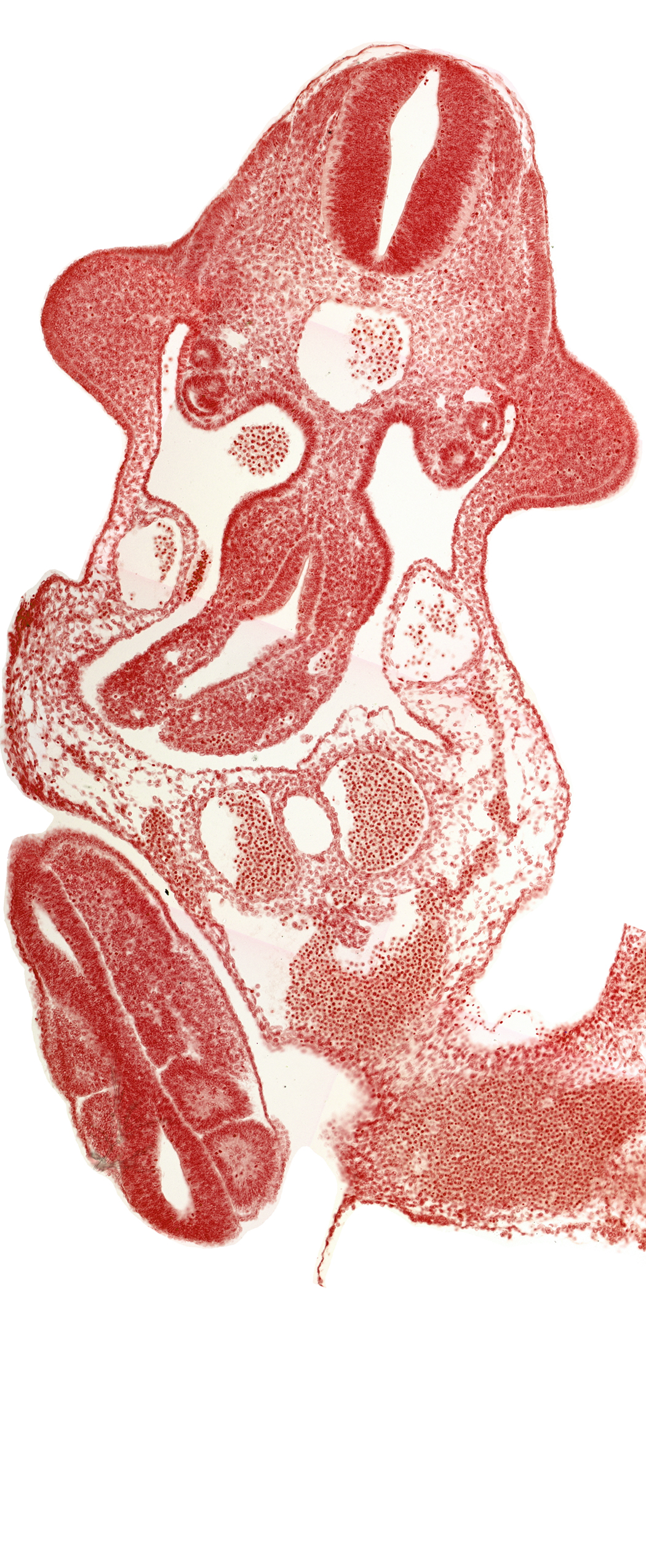 allantois, aorta, coelomic cavity, dermatomyotome 11 (C-7), left umbilical artery, left umbilical vein, marginal layer, mesentery proper, neural tube, paraxial mesoderm, right umbilical artery, right umbilical vein, roof plate, somite 30 (S-1), somite 31 (S-2), somite 32 (S-3), sulcus limitans, upper limb bud