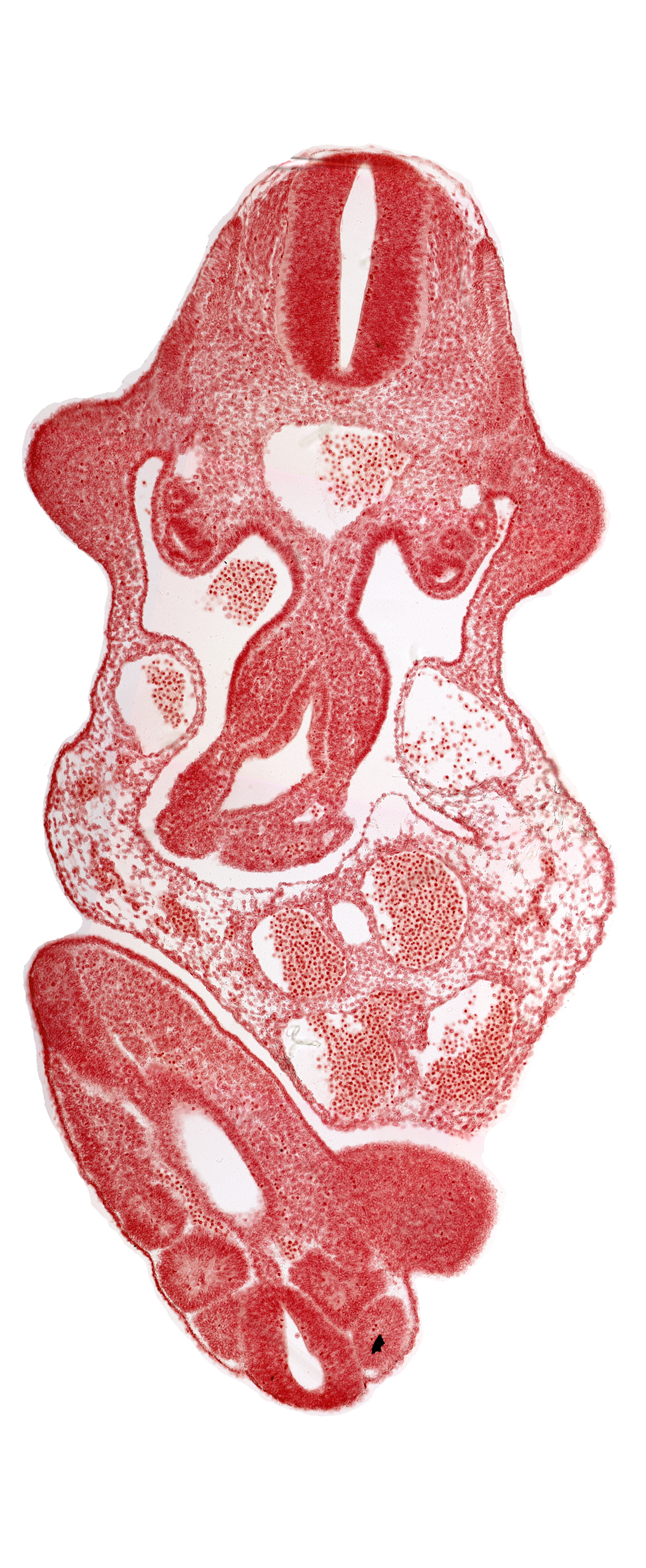 alar plate(s), aorta, basal plate, caudal edge of cloaca, caudal eminence, coelomic cavity, dermatomyotome 11 (C-7), left umbilical artery, left umbilical vein, lower limb bud, mesonephric duct, mesonephros, neural canal, notochord, somite 30 (S-1), somite 31 (S-2), sulcus limitans, upper limb bud