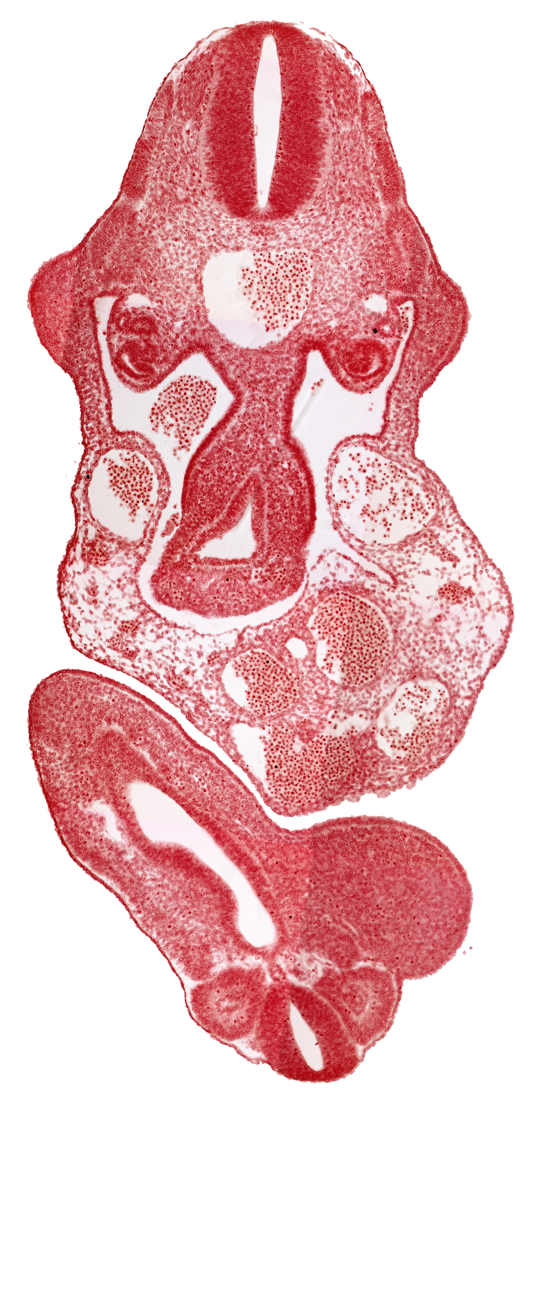 C-7 spinal ganglion primordium, abdominal wall, allantois, aorta, caudal eminence, cloaca, dermatomyotome 11 (C-7), dermatomyotome 12 (C-8), junction of midgut and omphalo-enteric duct, lower limb bud, mesonephric duct, neural tube, postcardinal vein, right umbilical artery, somite 29 (L-5), somite 30 (S-1), upper limb bud