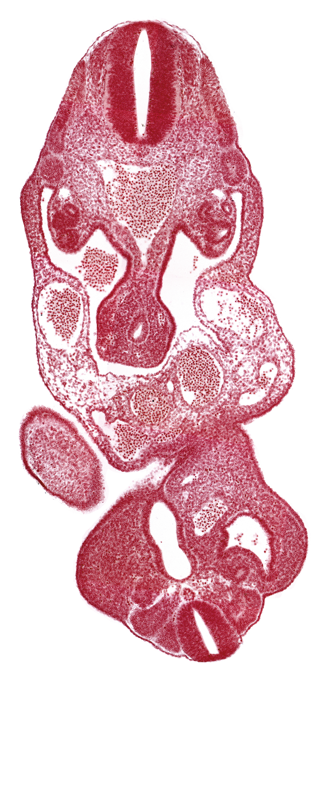 aorta, caudal eminence, cloaca, coelom, dermatomyotome 13 (T-1), left umbilical artery, left umbilical vein, lower limb bud, mesonephric duct, notochord, primary intestinal plexus artery, right umbilical vein, somite 28 (L-4)