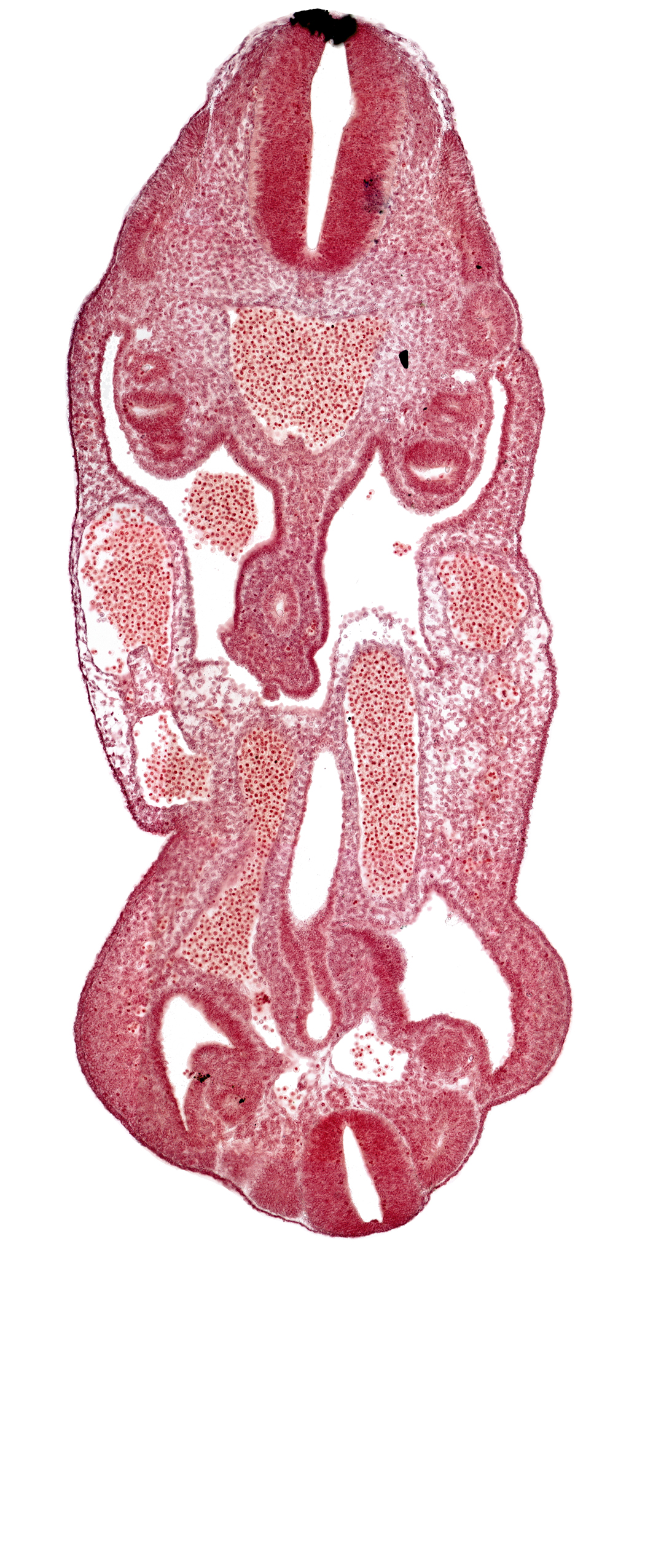 aorta, coelom, dermatomyotome 14 (T-2), dermatomyotome 27 (L-3), hindgut, left common iliac artery, left umbilical artery, mesonephric duct, neural canal, notochord, rectum primordium, right umbilical vein, urogenital sinus, urorectal septum