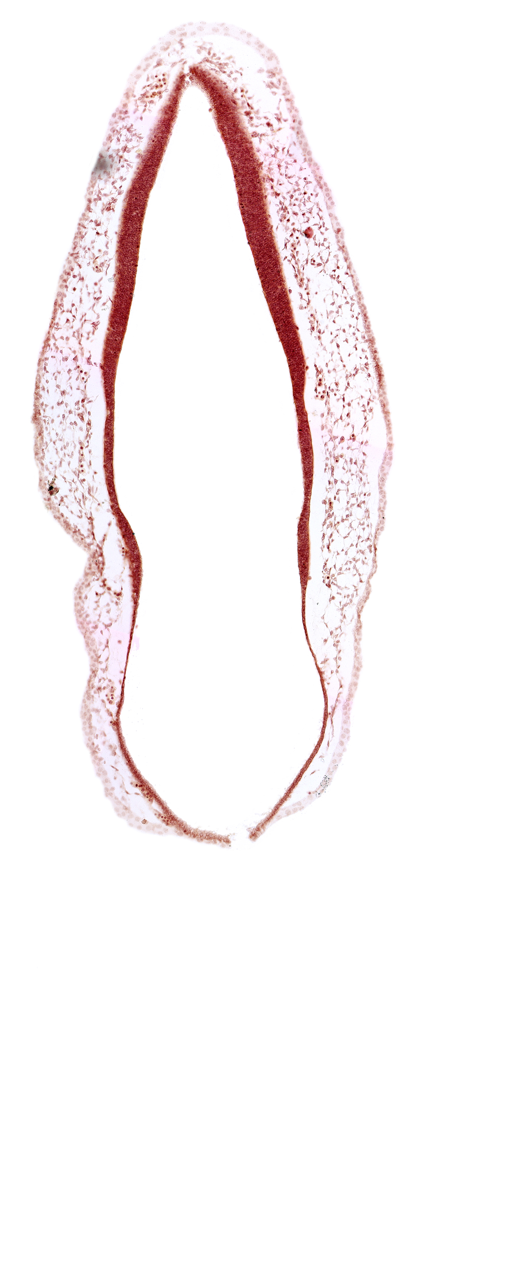 alar plate of rhombencephalon, head mesenchyme, rhombencoel (fourth ventricle), roof plate of rhombencephalon, surface ectoderm