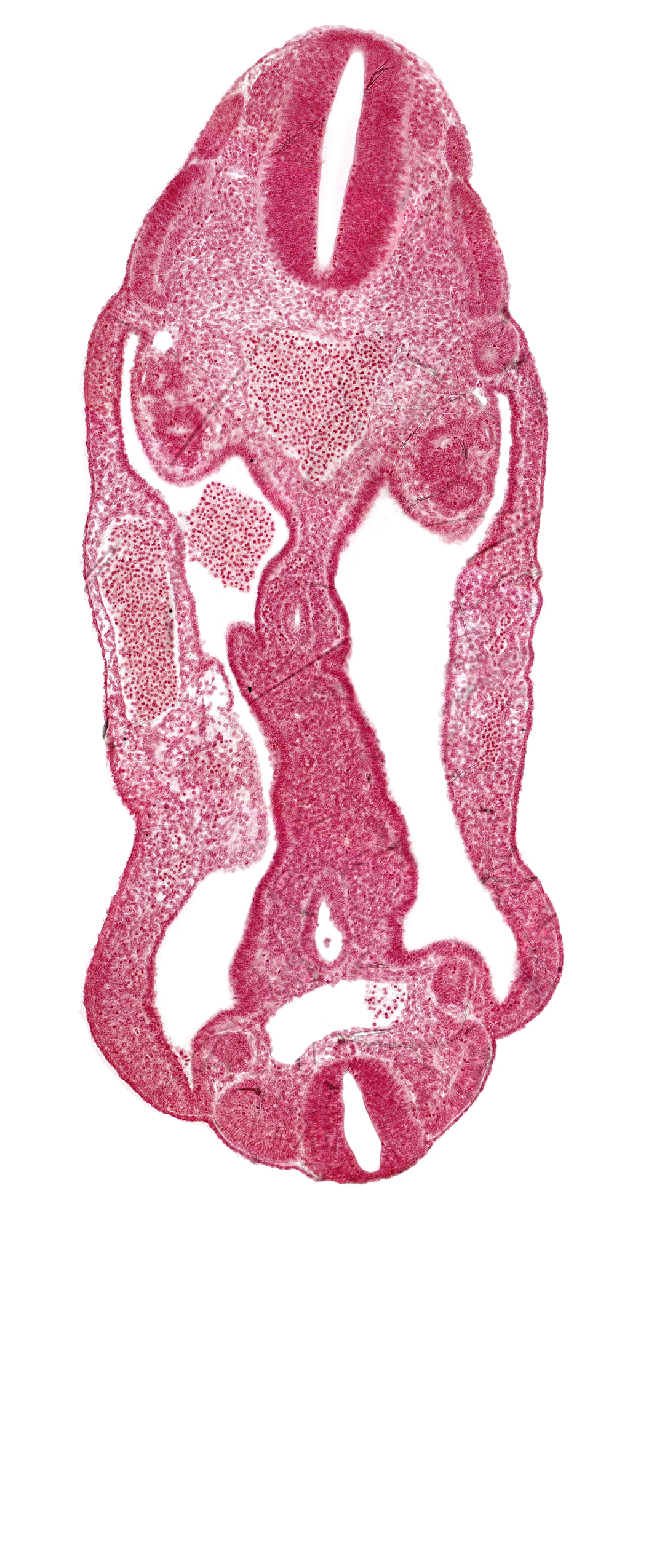 aorta, aortic bifurcation, coelom, dermatomyotome 14 (T-2), dermatomyotome 15 (T-3), dermatomyotome 26 (L-2), hindgut, mesentery, neural tube, sclerotome