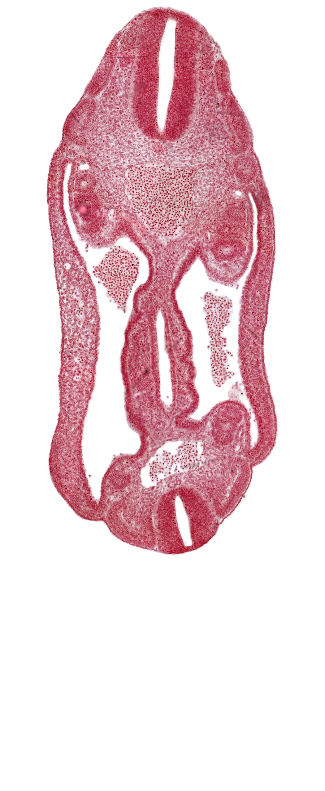 aorta, dermatomyotome 15 (T-3), dermatomyotome 16 (T-4), dermatomyotome 17 (T-5), dermatomyotome 25 (L-1), hindgut, mesentery, mesonephros, neural tube