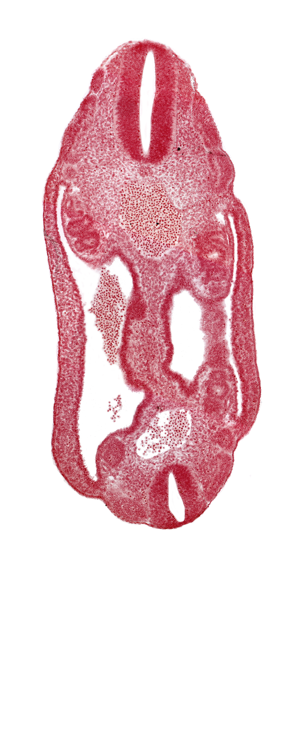aorta, coelom, dermatomyotome 16 (T-4), dermatomyotome 17 (T-5), dermatomyotome 25 (L-1), mesonephric duct, mesonephric vesicle(s), mesothelium, neural tube, notochord, sclerotome, somatic mesoderm, splanchnic mesoderm