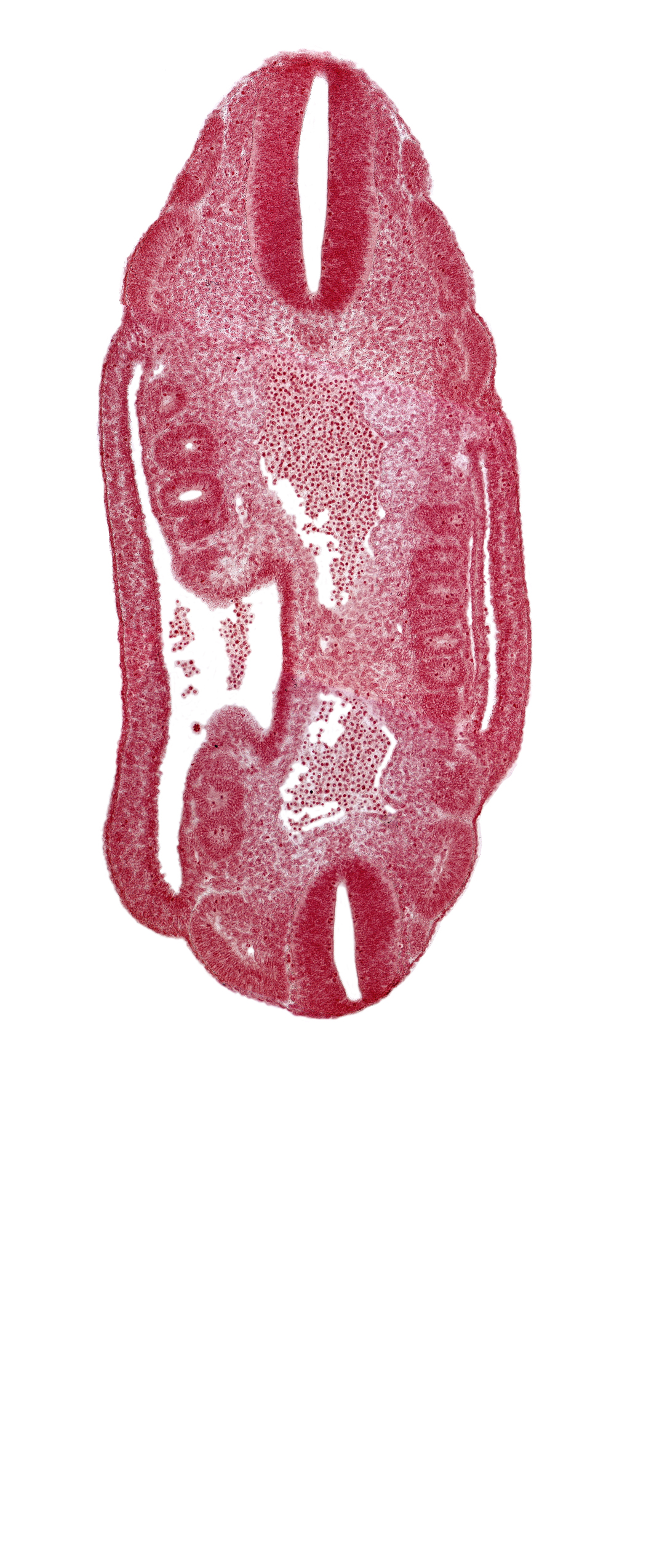 T-4 spinal ganglion primordium, aorta, dermatomyotome 16 (T-4), dermatomyotome 17 (T-5), dermatomyotome 18 (T-6), dermatomyotome 24 (T-12), mesonephric duct, mesonephric ridge, mesonephric vesicle(s), neural tube
