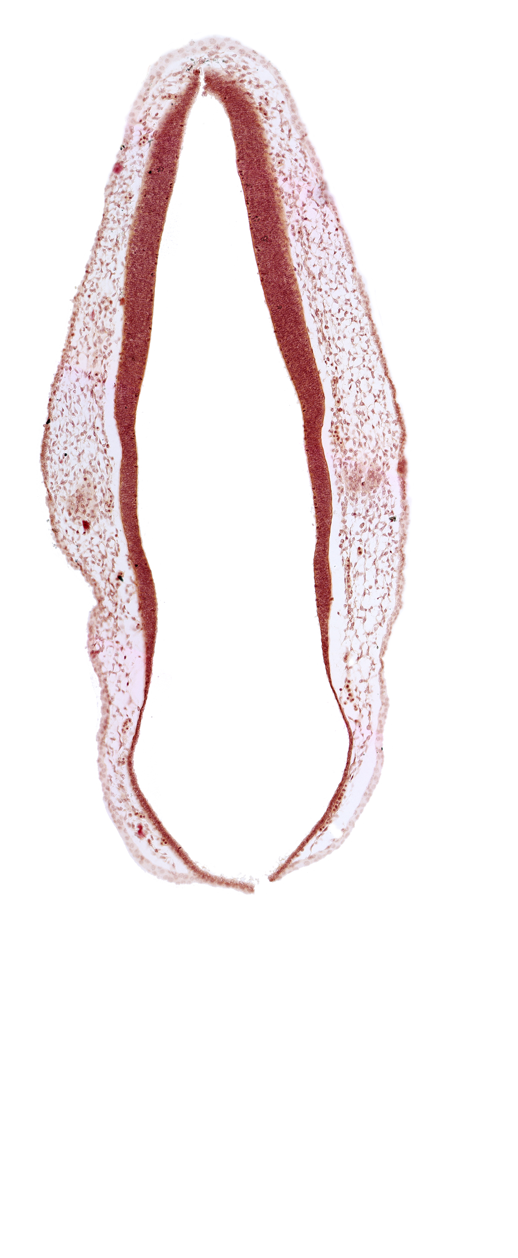 alar plate of rhombencephalon, cephalic edge of otic vesicle, ectodermal tag of otic vesicle, rhombencoel (fourth ventricle), roof plate of rhombencephalon