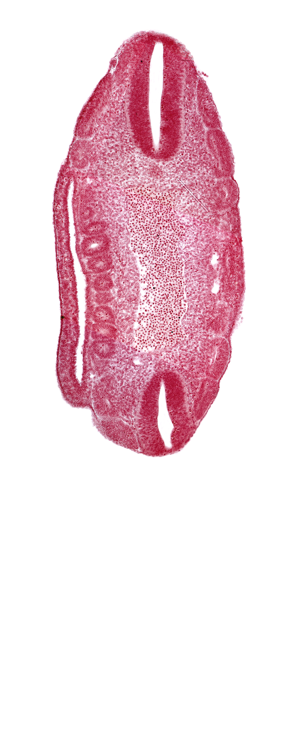 aorta, coelom, dermatomyotome 17 (T-5), dermatomyotome 18 (T-6), dermatomyotome 19 (T-7), dermatomyotome 22 (T-10), dermatomyotome 23 (T-11), dermatomyotome 24 (T-12), mesonephric vesicle(s)