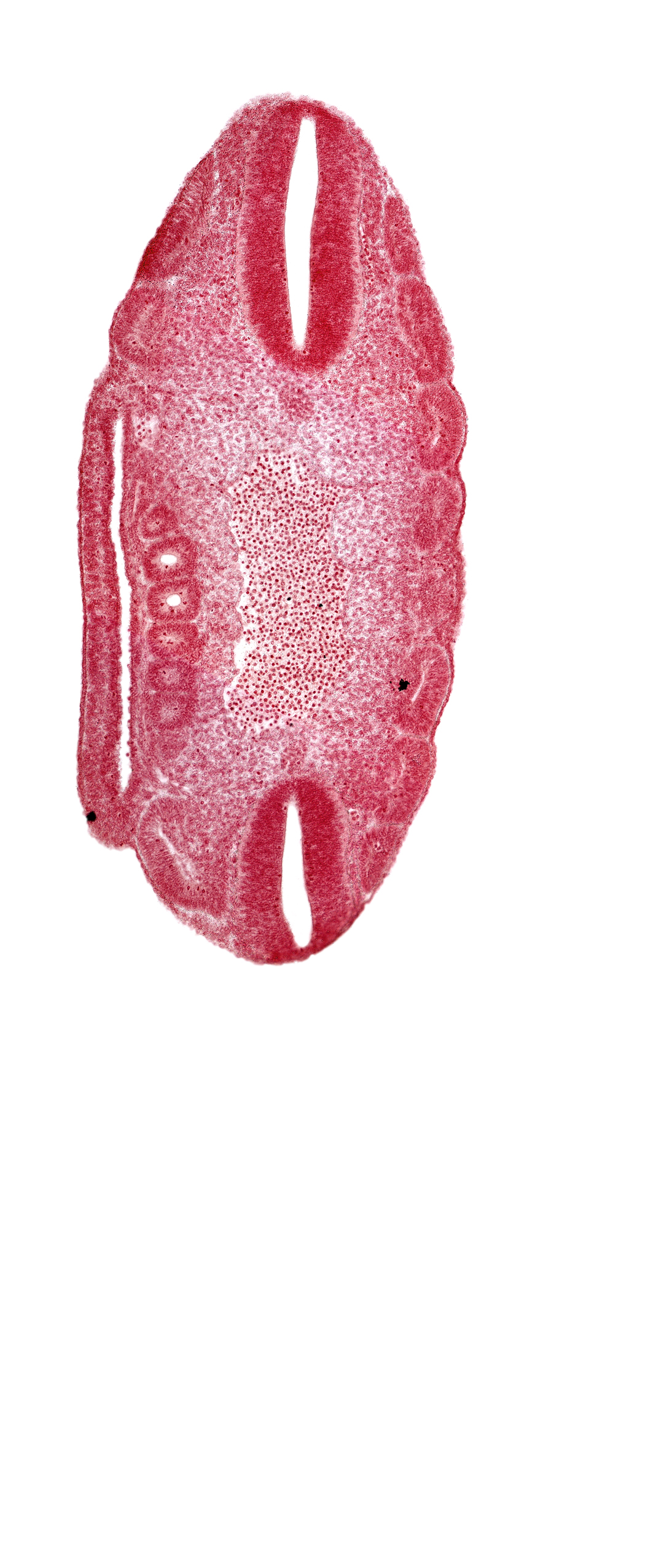 aorta, coelom, dermatomyotome 17 (T-5), dermatomyotome 18 (T-6), dermatomyotome 19 (T-7), dermatomyotome 20 (T-8), dermatomyotome 22 (T-10), dermatomyotome 23 (T-11), dermatomyotome 24 (T-12), mesonephric vesicle(s)