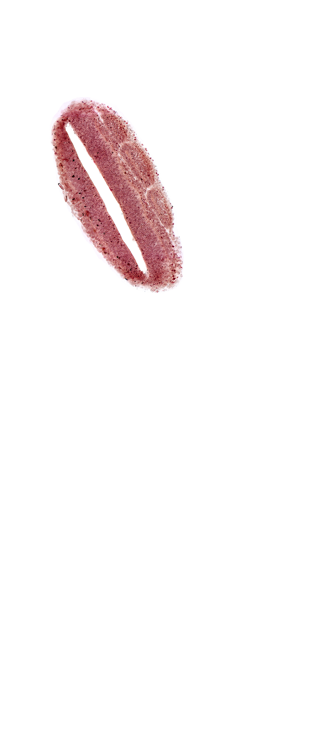 dermatomyotome 21 (T-9), lumen of neural tube