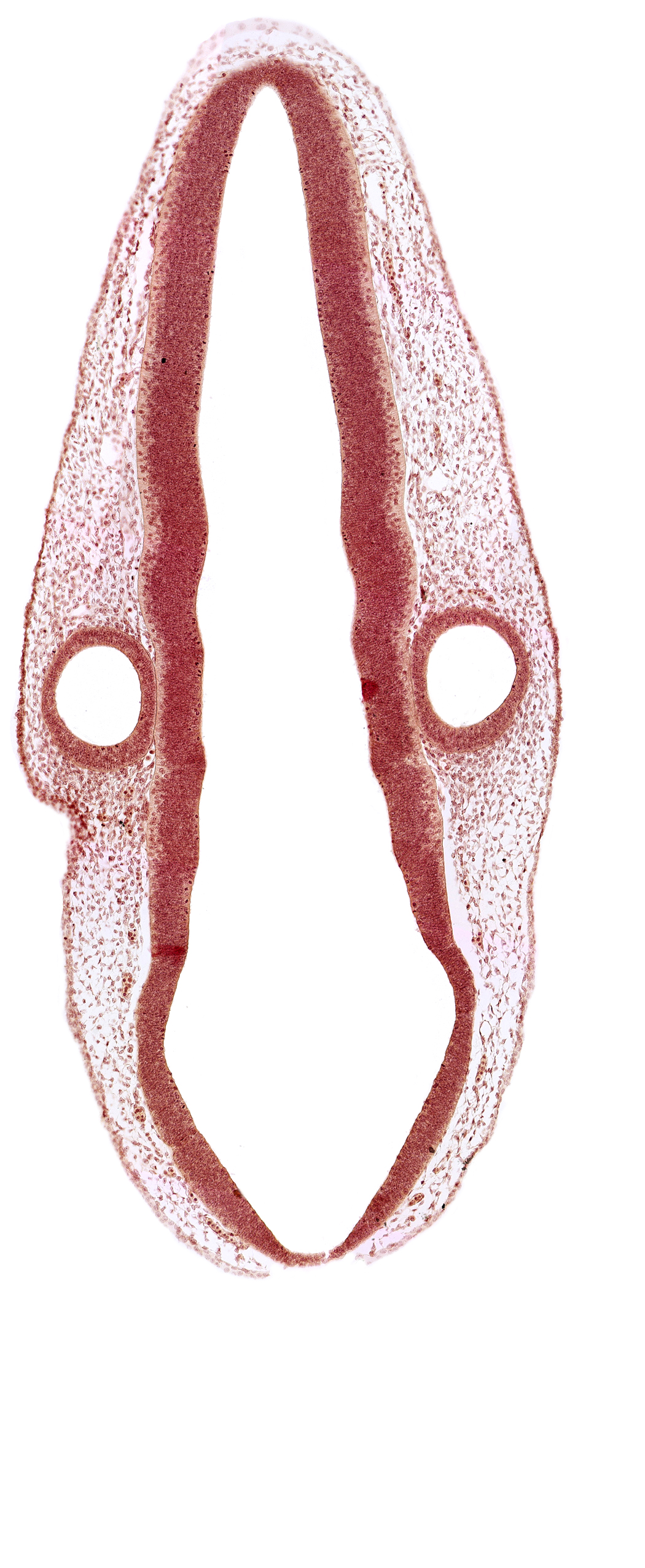 head mesenchyme, mantle layer, marginal layer, otic vesicle, posterior dural venous plexus, rhombencoel (fourth ventricle), surface ectoderm