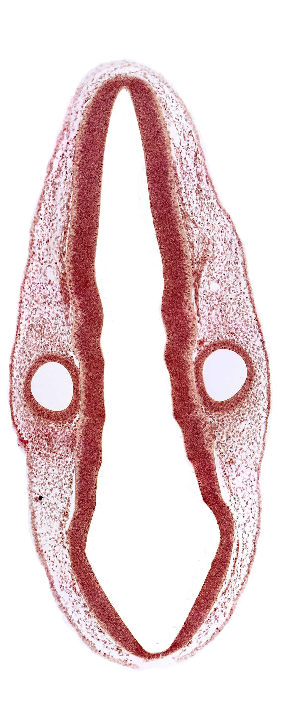 mantle layer, marginal layer, middle dural venous plexus, otic vesicle, rhombencephalon (hindbrain), rhombencoel (fourth ventricle), rhombomere 4, rhombomere 6, rhombomere 7, roof plate