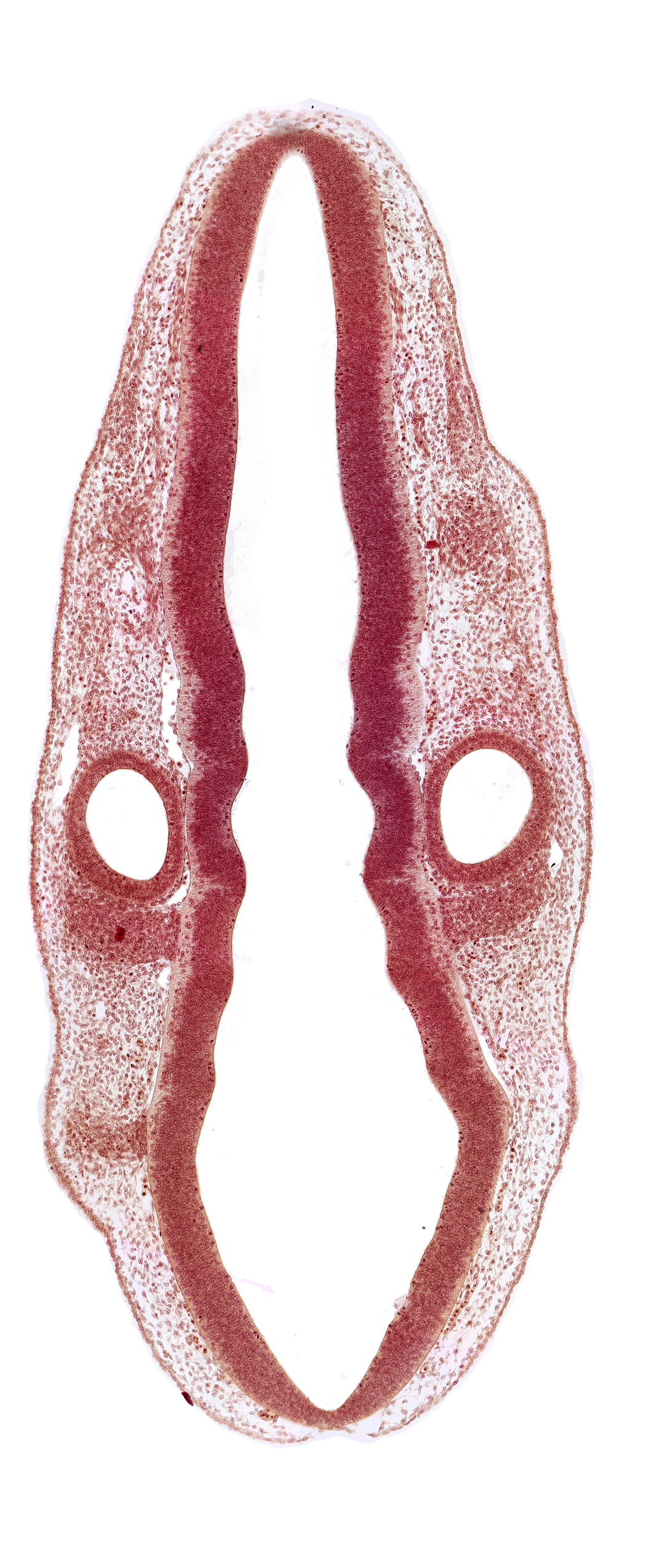 dermatomyotome 1 (O-1), primordium of facial and vestibulocochlear nerves (CN VII and CN VIII), primordium of glossopharyngeal nerve (CN IX), primordium of vagus nerve (CN X), rhombencoel (fourth ventricle), rhombomere 5, rhombomere 6, rhombomere 7