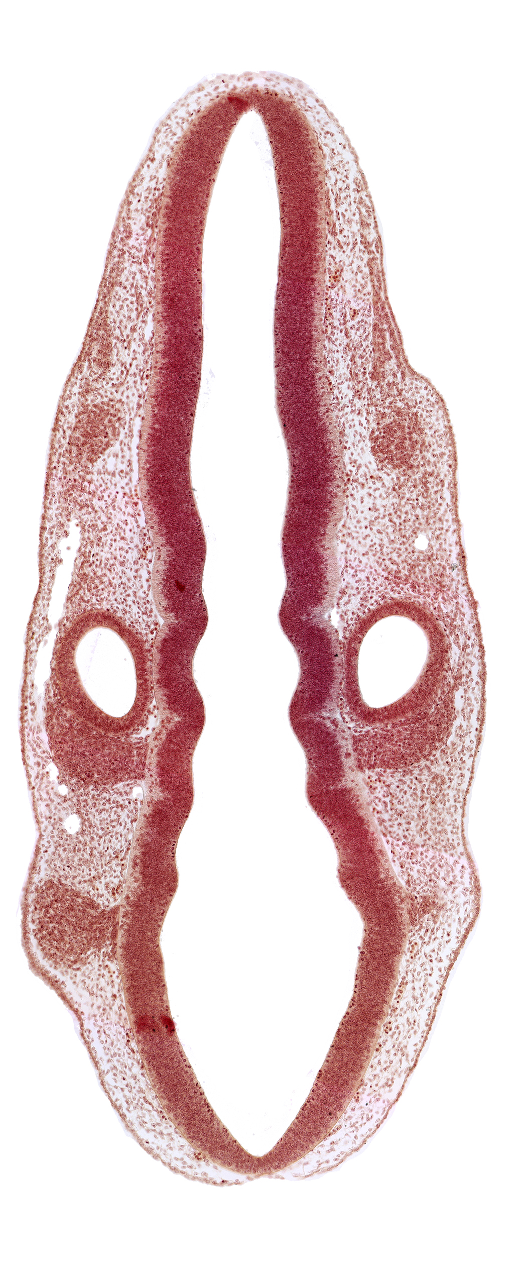 dermatomyotome 1 (O-1), middle dural venous plexus, primordium of facial and vestibulocochlear nerves (CN VII and CN VIII), primordium of glossopharyngeal nerve (CN IX), rhombencoel (fourth ventricle), rhombomere 5, rhombomere 6, rhombomere 7, root of trigeminal nerve (CN V)