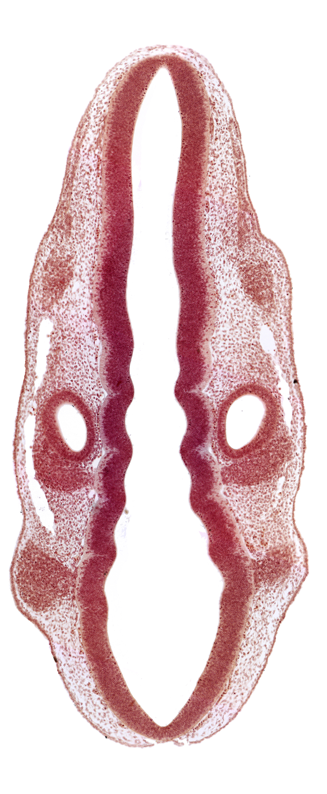 dermatomyotome 1 (O-1), dermatomyotome 2 (O-2) , marginal layer, otic vesicle, primary head vein, primordium of facial and vestibulocochlear nerves (CN VII and CN VIII), primordium of trigeminal nerve (CN V), primordium of vagus nerve (CN X), rhombencoel (fourth ventricle), rhombomere 2, rhombomere 4, rhombomere 5, rhombomere 6