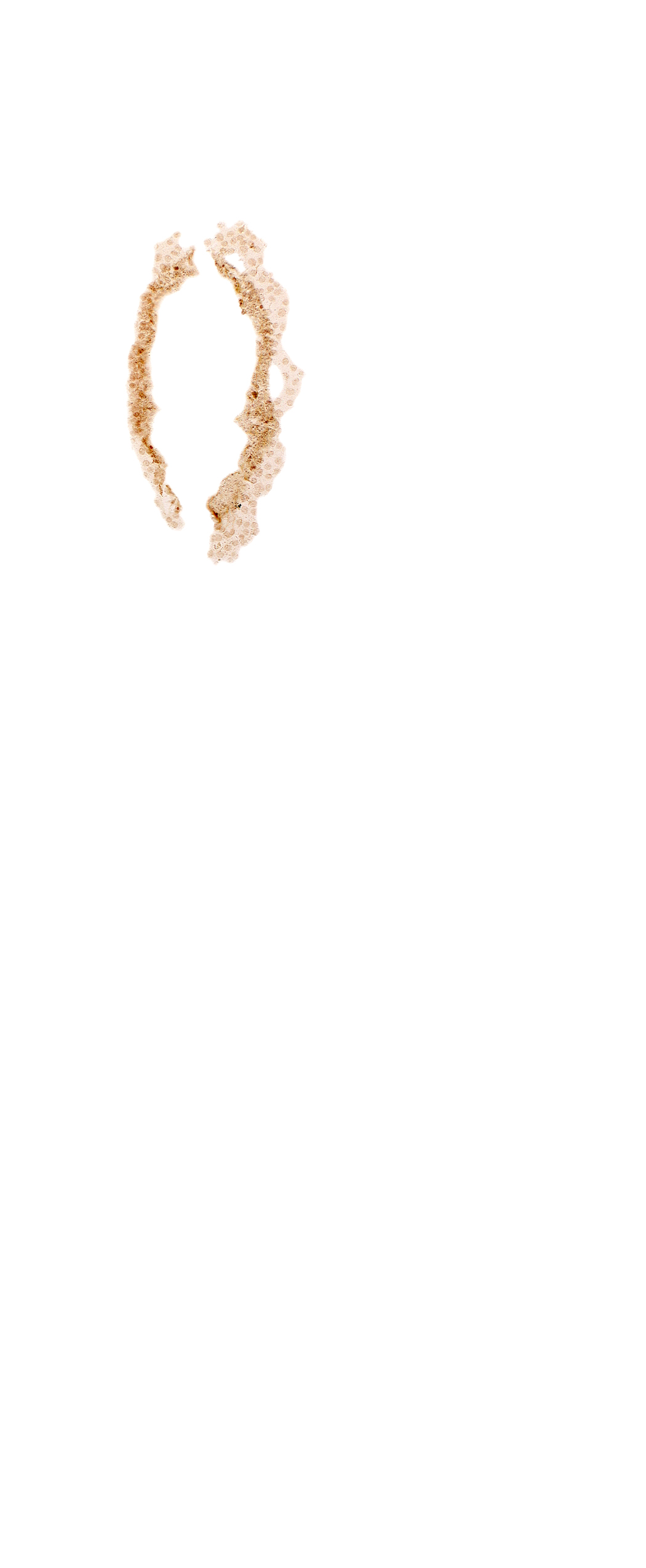 roof plate of rhombencephalon, surface ectoderm