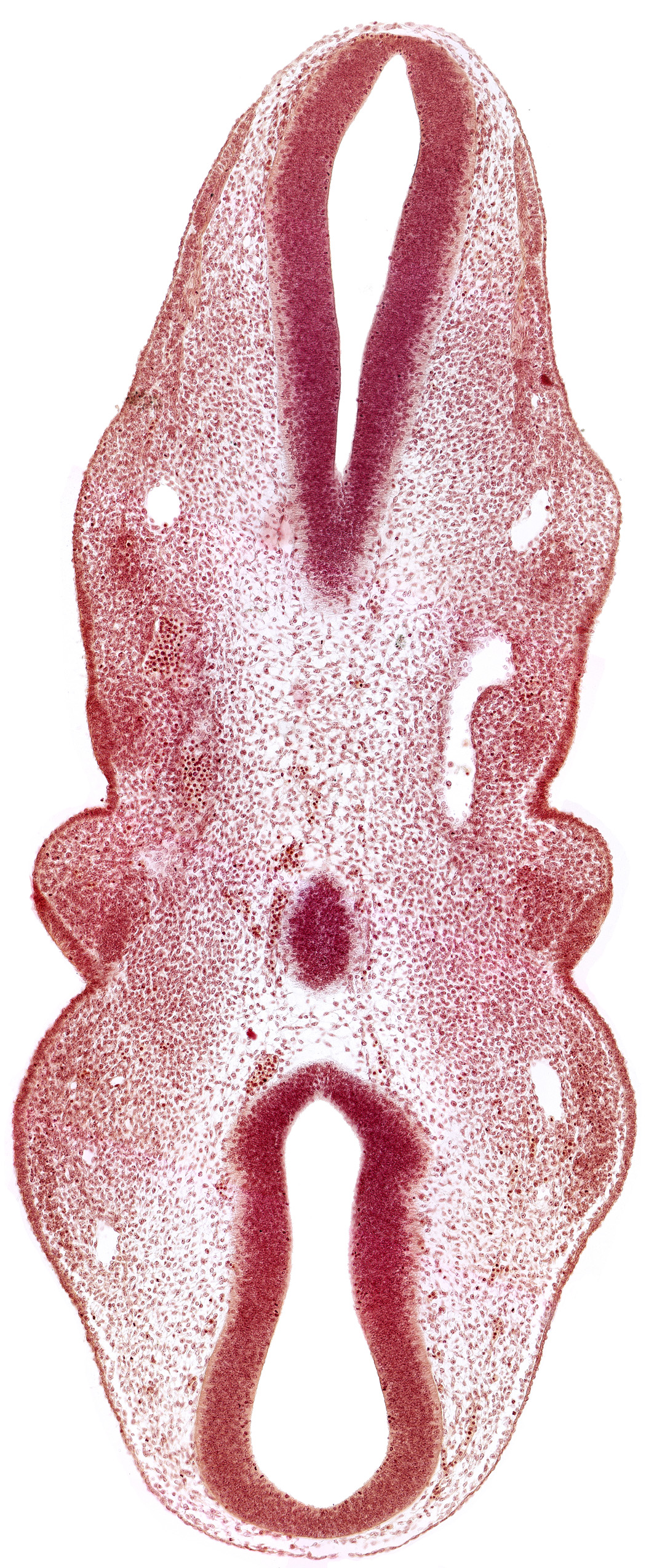 cephalic edge of dorsal aorta