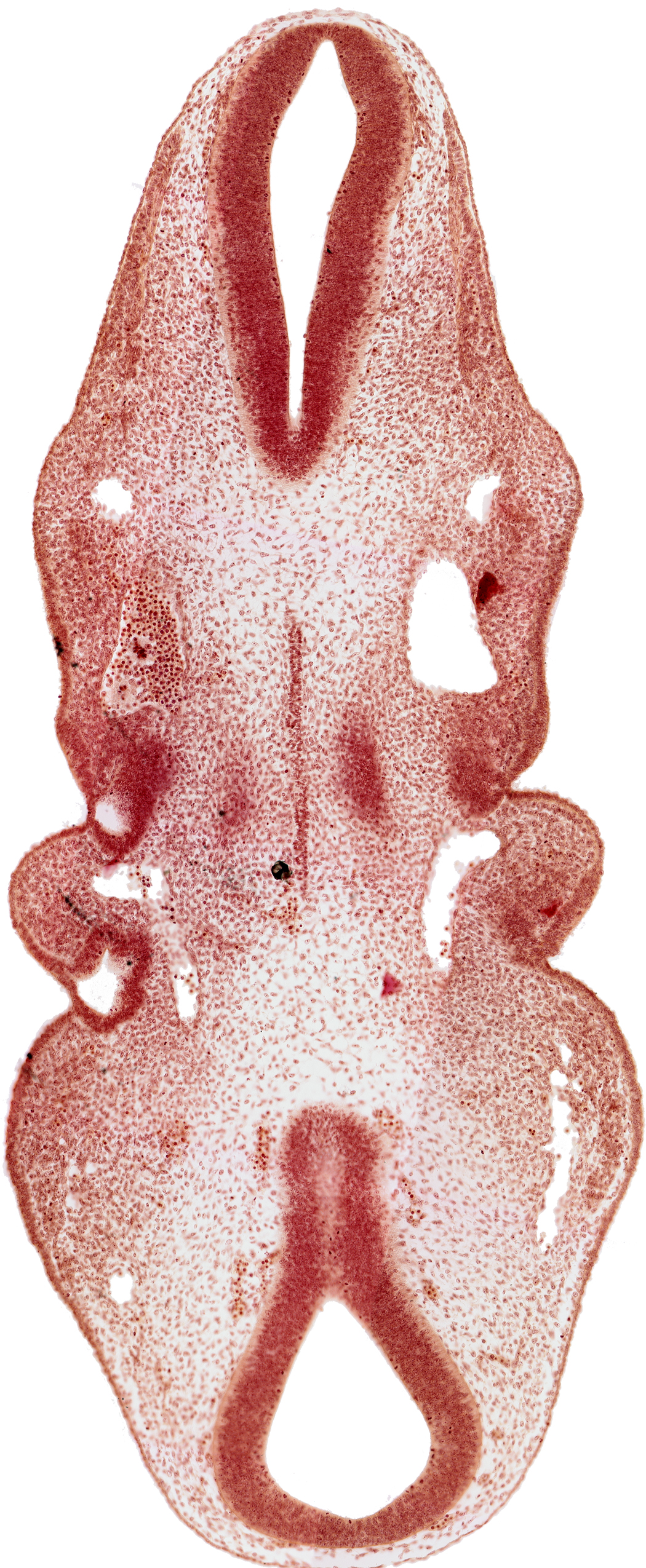 notochord, roof of pharynx primordium