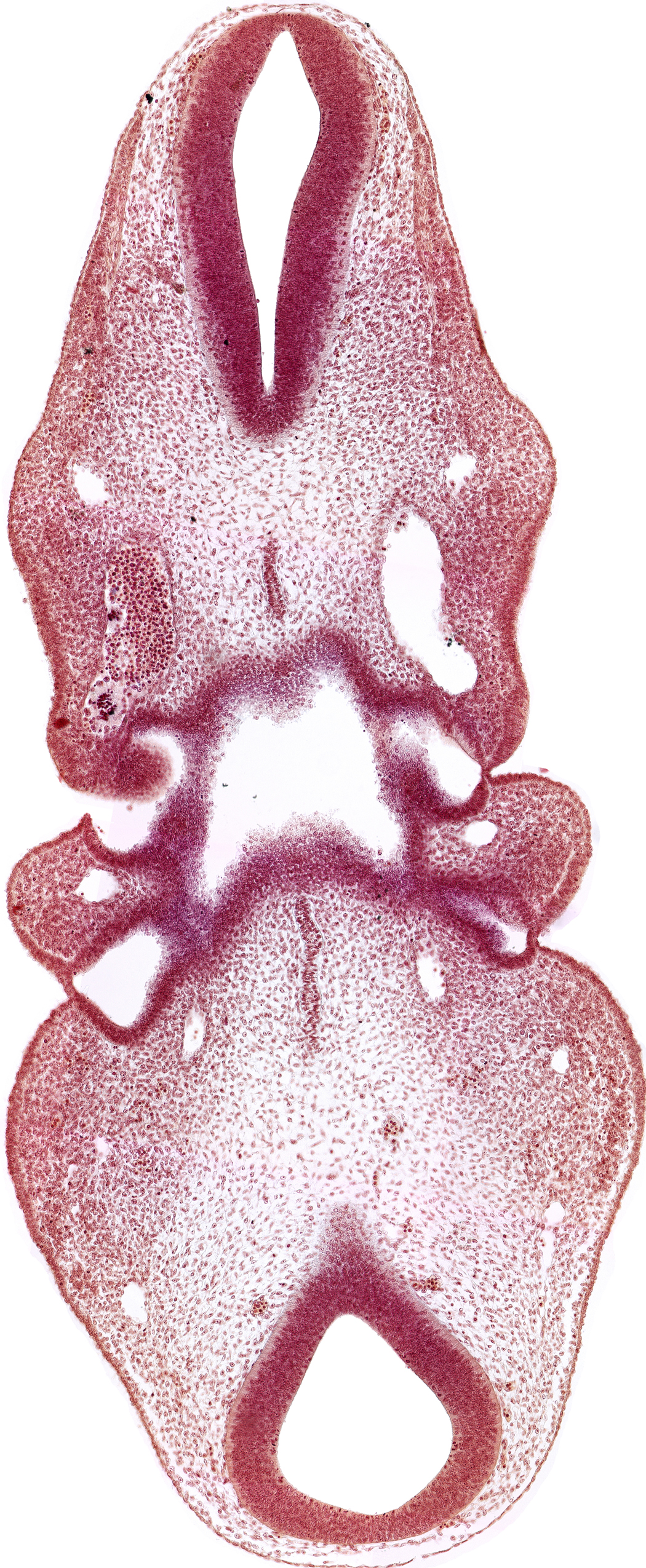 junction of aortic arch 3 and dorsal aorta, notochord, pharynx primordium