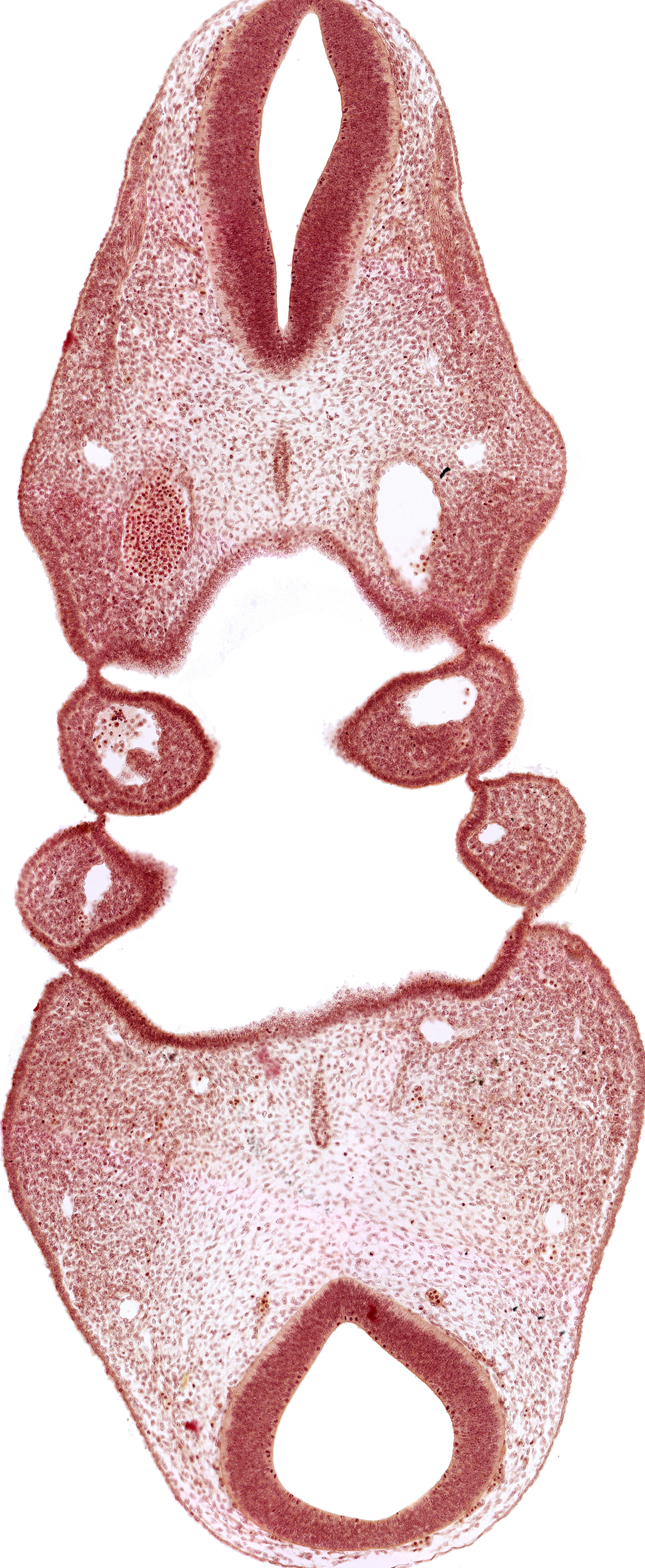 aortic arch 3, dorsal aorta (aortic arch 4), internal carotid artery, notochord, region of mesencephalic (cephalic) flexure