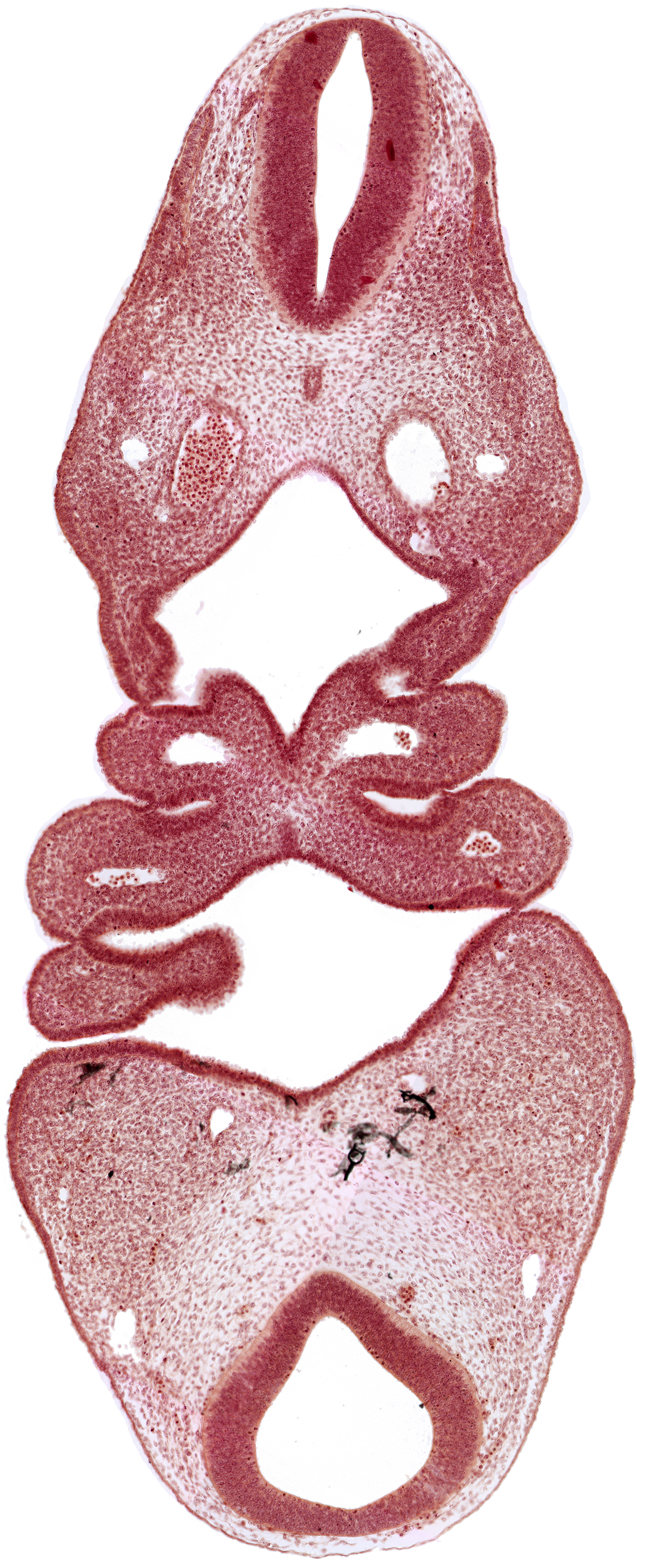 aortic arch 2, dermatomyotome 4 (O-4) , dermatomyotome 5 (C-1), dorsal aorta, junction of rhombencephalon and spinal cord, mandibular prominence of pharyngeal arch 1, notochord, pharyngeal arch 2, pharyngeal pouch 1, precardinal vein, thyroid diverticulum