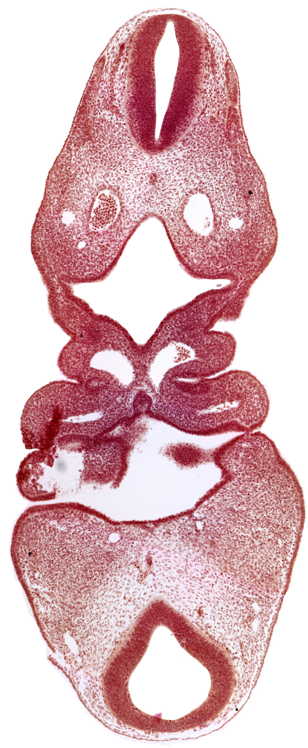 C-1 spinal ganglion primordium, adenohypophysial pouch, anterior dural venous plexus, cervical sinus, dermatomyotome 5 (C-1), epicardial ridge, epipharyngeal placode 4, internal carotid artery, mesencephalon, notochord, pharyngeal arch 3, pharyngeal arch 4, pharyngeal pouch 1, pharyngeal pouch 2, pharynx primordium, precardinal vein