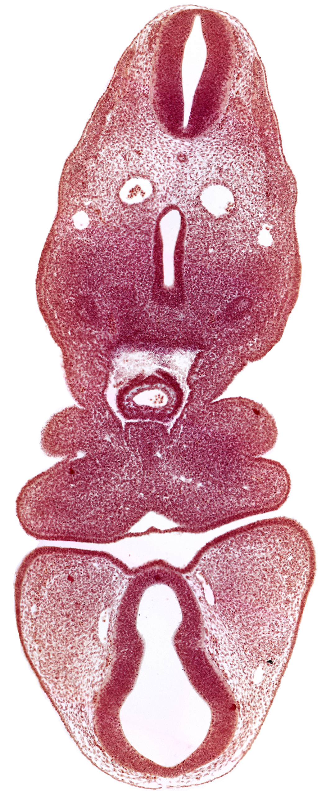 caudal edge of ultimopharyngeal pouch, caudal part of foregut, dermatomyotome 5 (C-1), dorsal aorta, dorsal thalamus (diencephalon), internal carotid artery, maxillary prominence of pharyngeal arch 1, oral fissure, pericardial cavity, pharyngeal arch 2, pharyngeal groove 1, precardinal vein, prosencoel (third ventricle), truncus arteriosus, ventral thalamus (diencephalon)