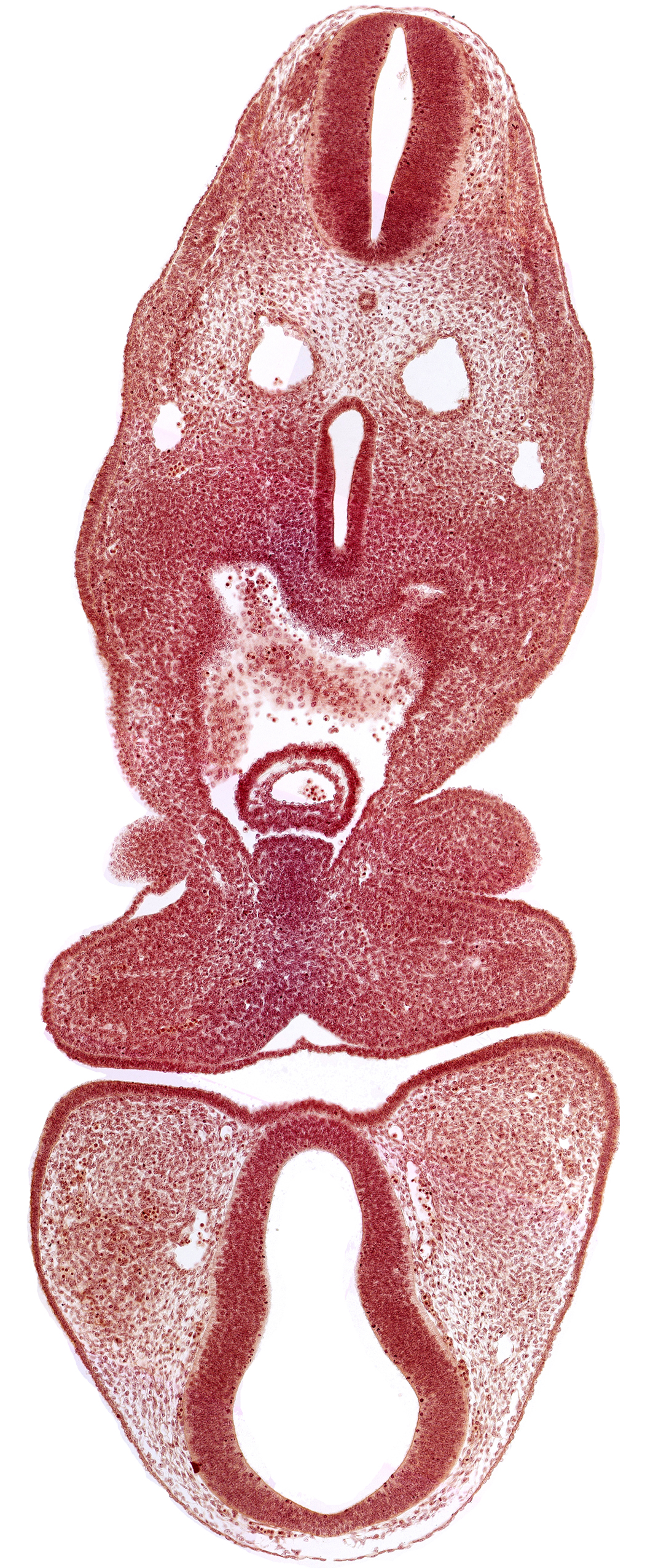 anterior dural vein, caudal edge of pharyngeal arch 2, cephalic edge of left atrium, dermatomyotome 5 (C-1), dorsal thalamus (diencephalon), mandibular prominence of pharyngeal arch 1, oral fissure, pericardial cavity, precardinal vein, prosencoel (third ventricle), separation artifact, truncus arteriosus, ventral thalamus (diencephalon)