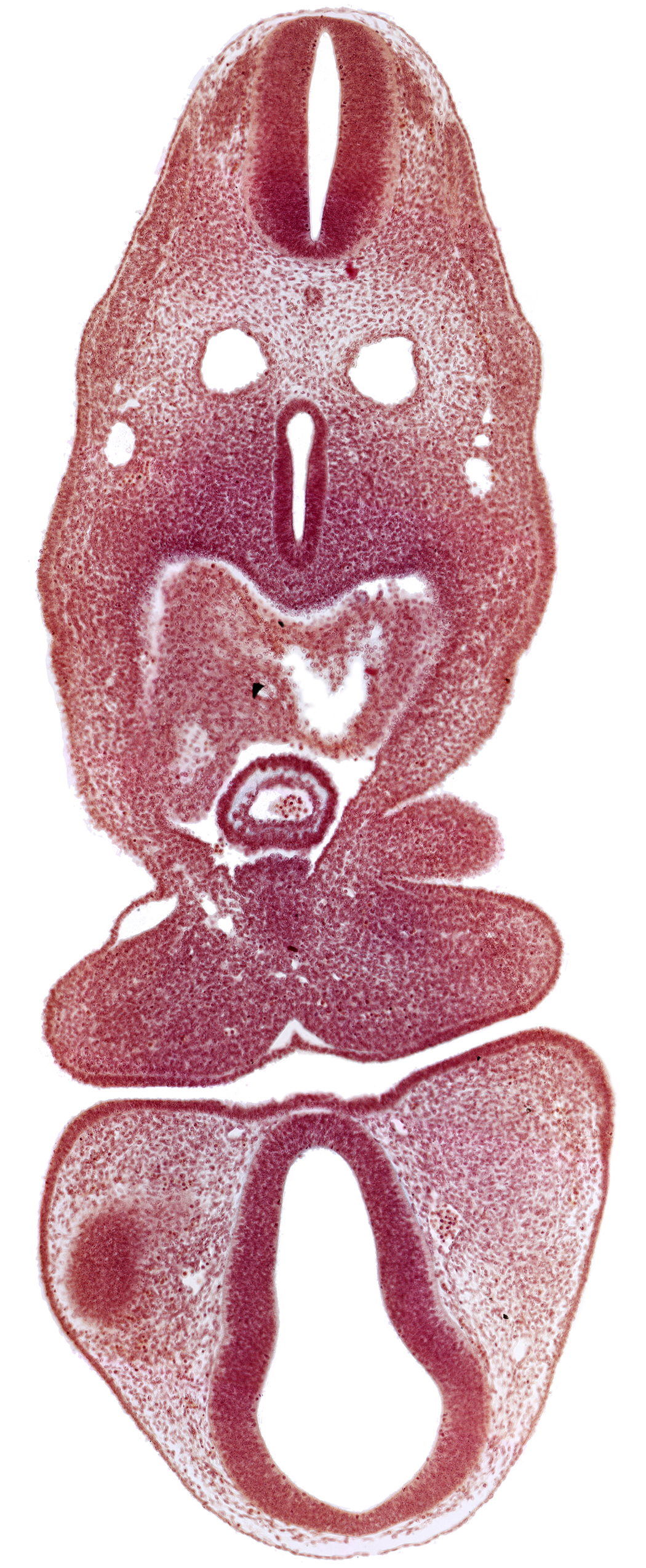 C-1 spinal ganglion primordium, anterior dural vein, caudal edge of optic vesicle, dermatomyotome 5 (C-1), dorsal thalamus (diencephalon), left atrium, mandibular prominence of pharyngeal arch 1, oral fissure, pericardial cavity, prosencoel (third ventricle), separation artifact, truncus arteriosus