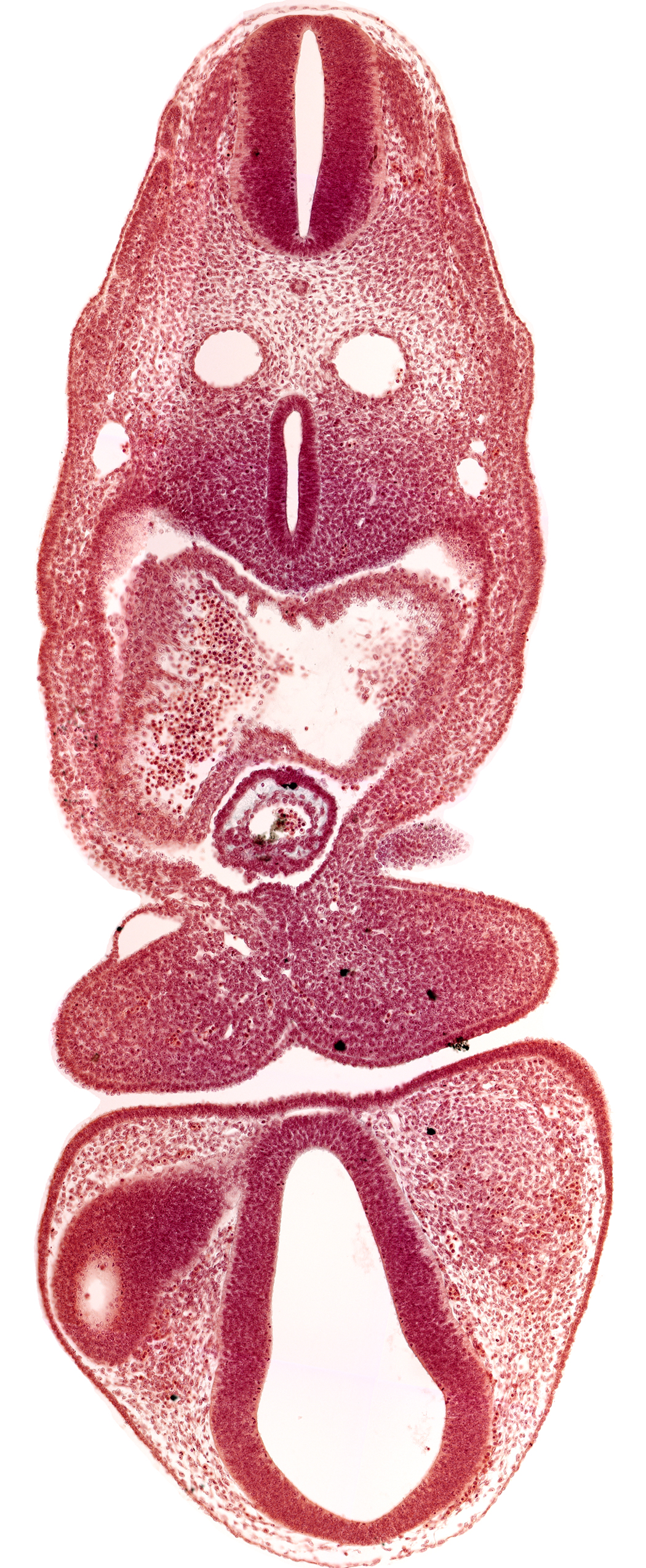 C-1 spinal ganglion primordium, caudal edge of pharyngeal arch 2, dermatomyotome 5 (C-1), dermatomyotome 6 (C-2), dorsal aorta, dorsal thalamus (diencephalon), left atrium, mandibular prominence of pharyngeal arch 1, optic vesicle, pericardial cavity, prosencoel (third ventricle), tracheo-esophageal tube, truncus arteriosus